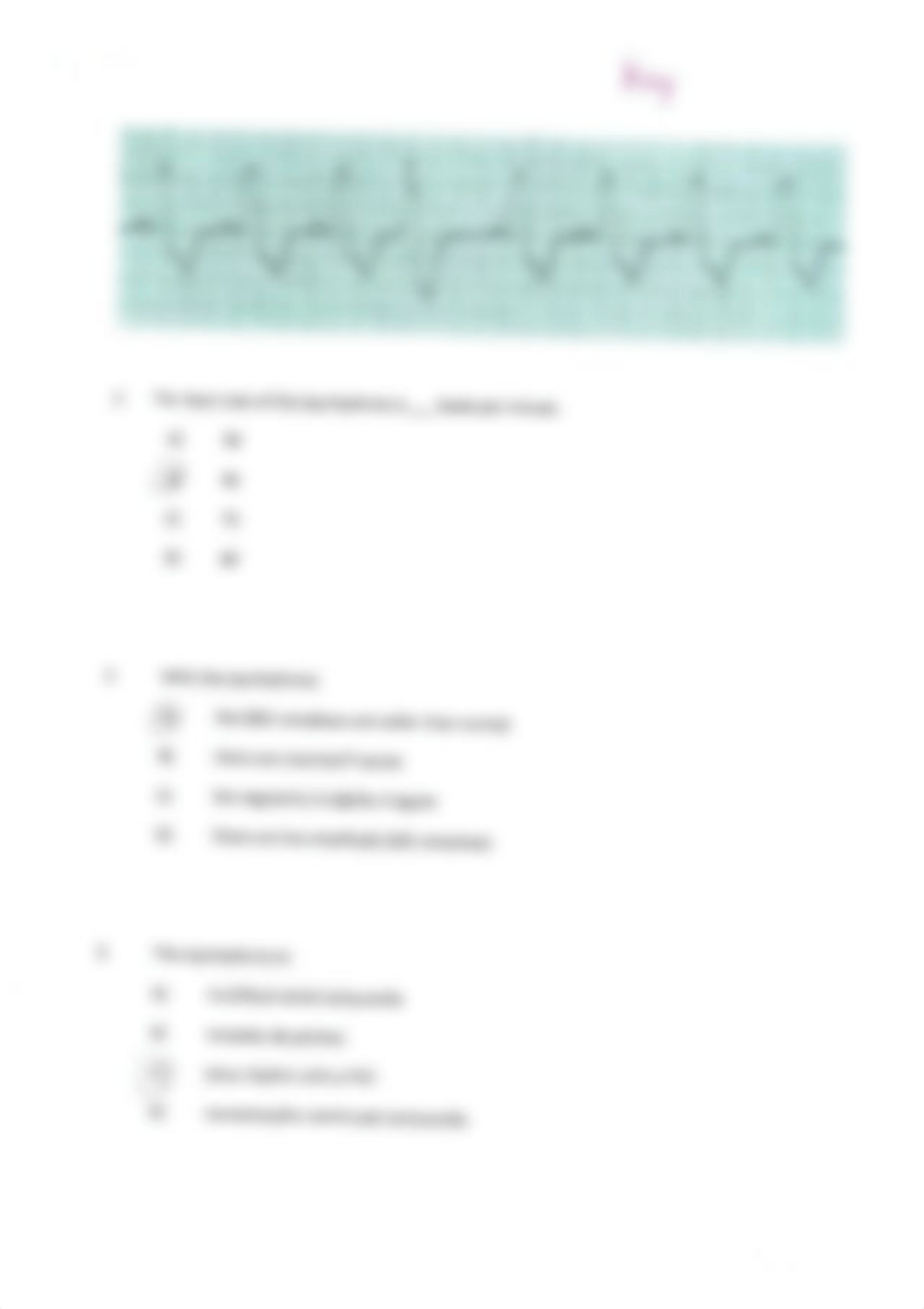 EKG Examples.pdf_dz2w5ac59i4_page1