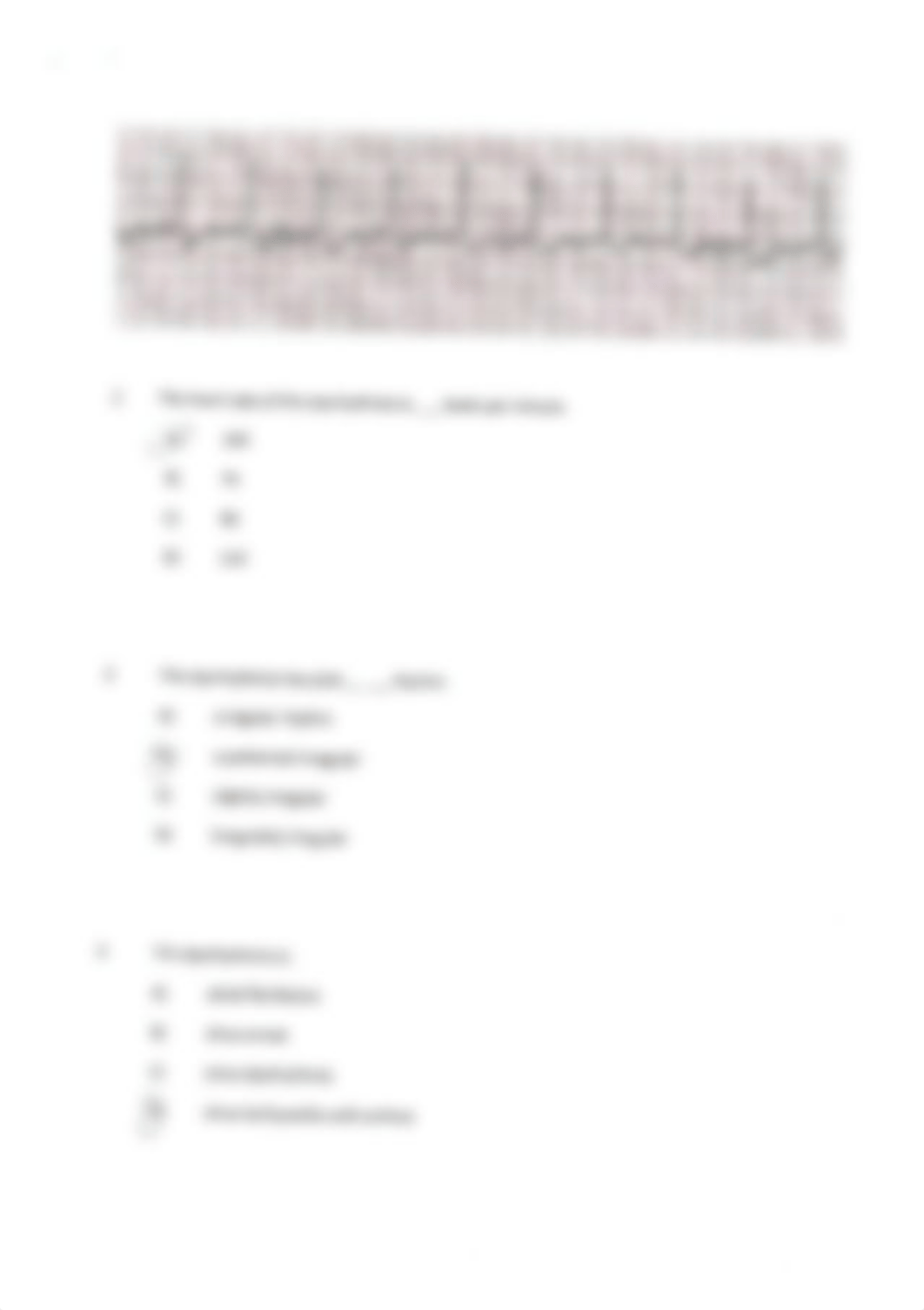 EKG Examples.pdf_dz2w5ac59i4_page2