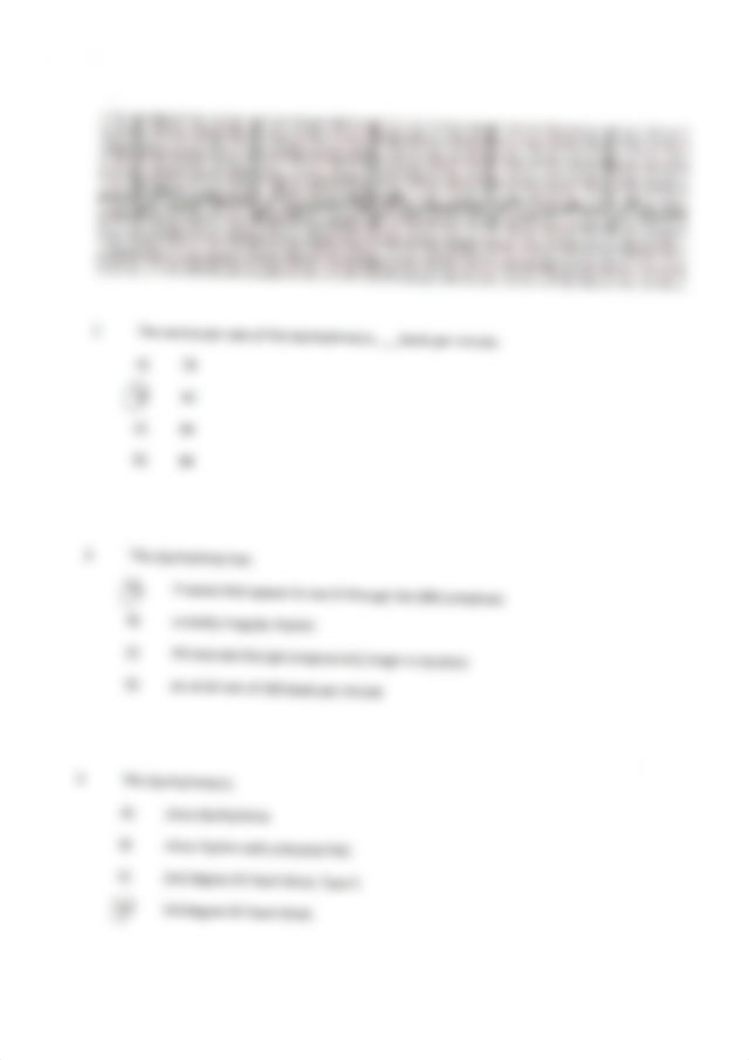 EKG Examples.pdf_dz2w5ac59i4_page5