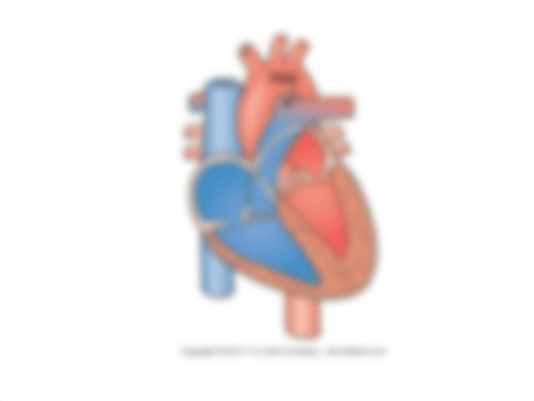 cong heart flashcards pediatrics.pptx_dz6dt7ya1ey_page1