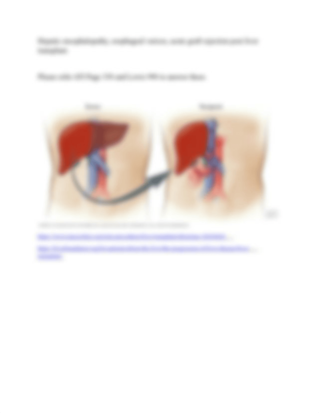 Liver Transplantation Template Assignment.docx_dz6tza06ym3_page2