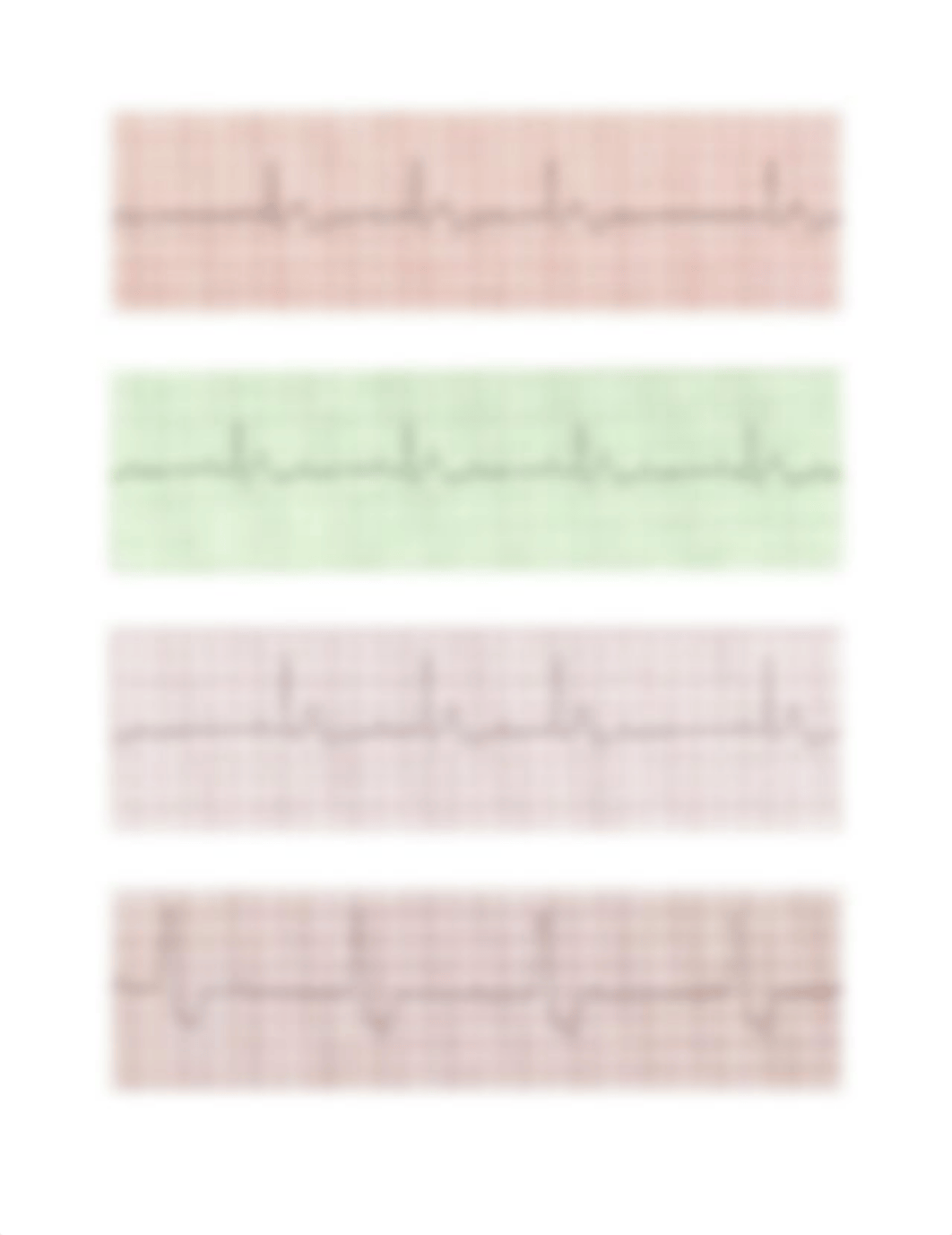 EKG Practice Strips Answers 2.docx_dz7wdo8hq5p_page3