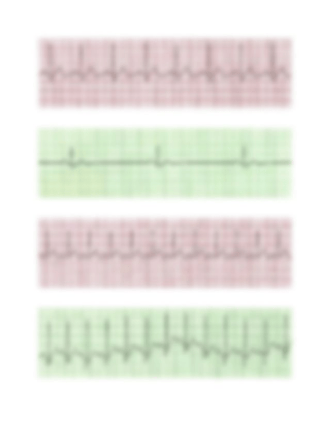 EKG Practice Strips Answers 2.docx_dz7wdo8hq5p_page1