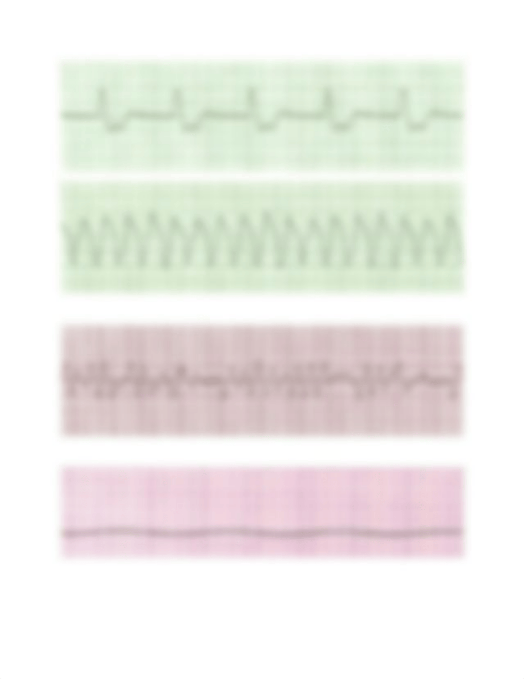 EKG Practice Strips Answers 2.docx_dz7wdo8hq5p_page4