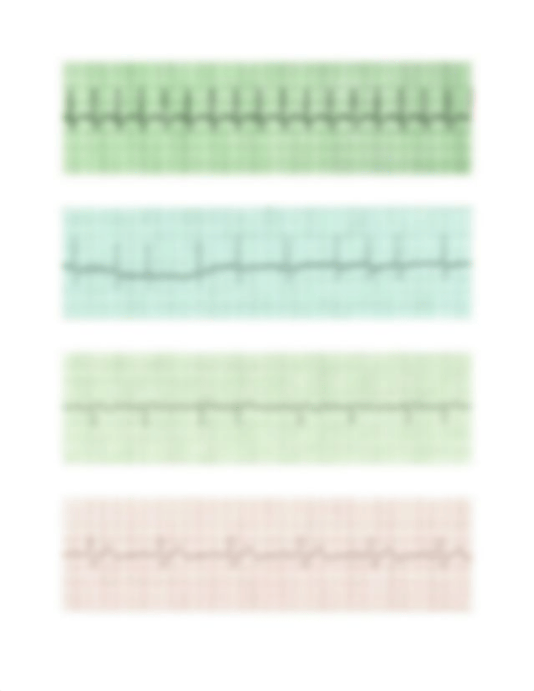 EKG Practice Strips Answers 2.docx_dz7wdo8hq5p_page2