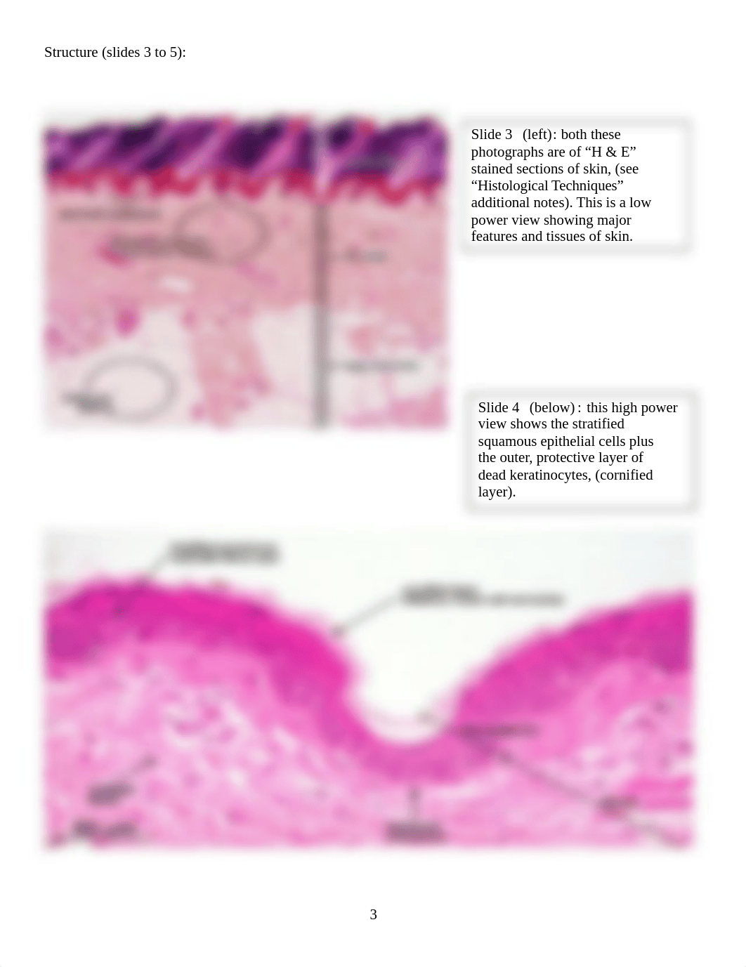 BSI L40 Integumentary System NOTES 2018.docx_dzahflnzq7y_page3