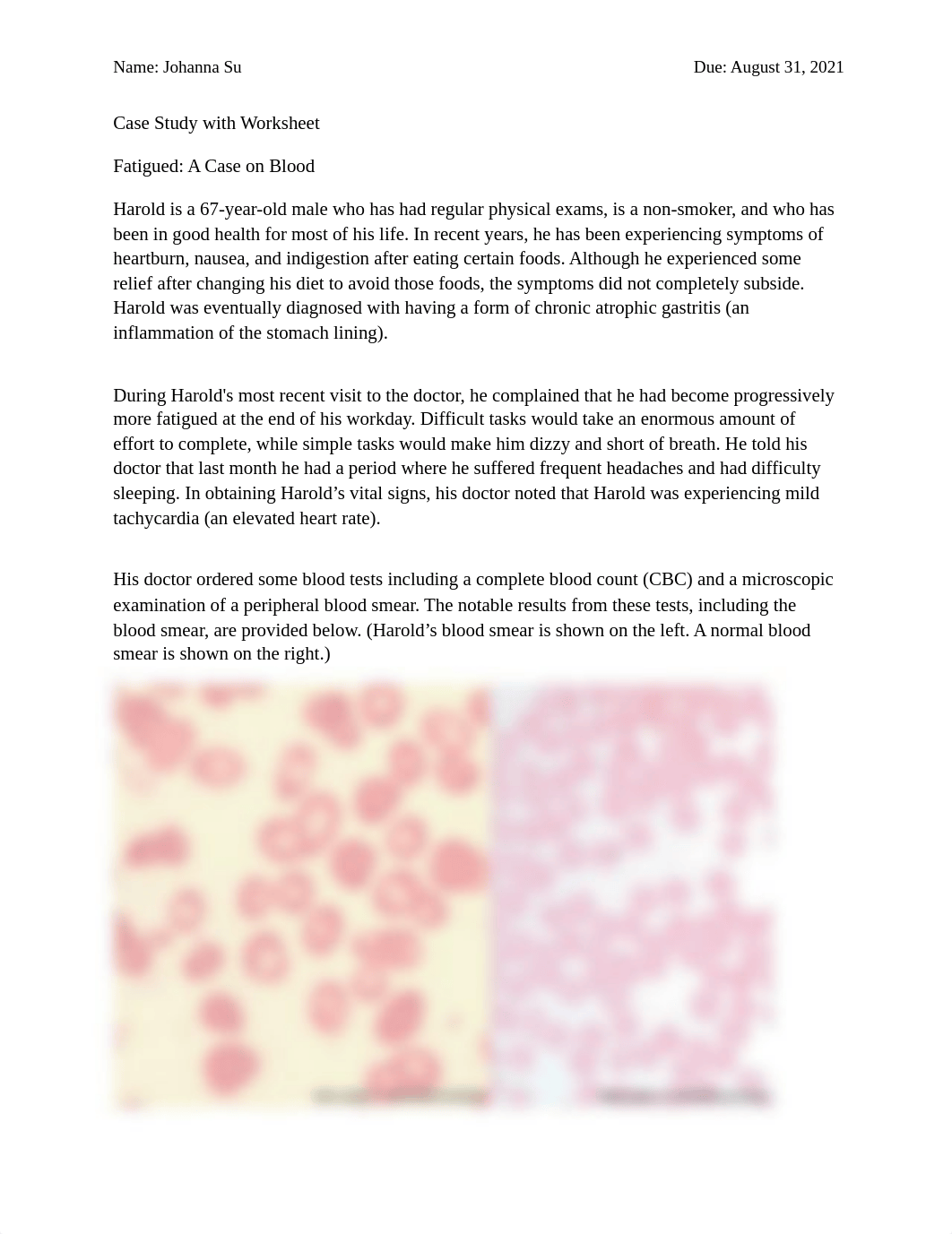 Blood_Case Study.pdf_dzhfrcdxncs_page1