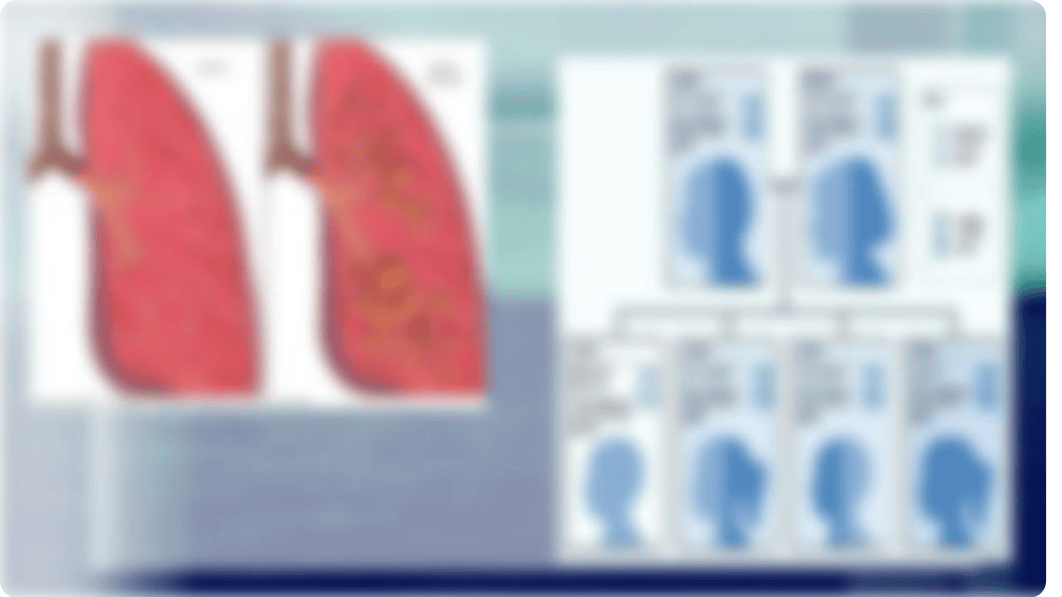 Cystic fibrosis final presentaion.pptx_dziqp48ve4t_page5