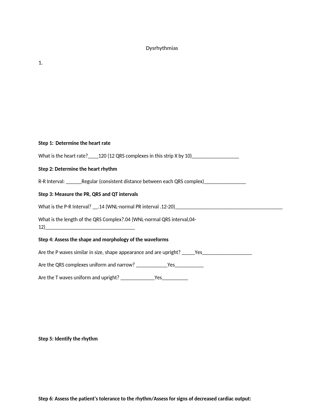 EKG in-class work sheet answers.docx_dzjvhilyy44_page1