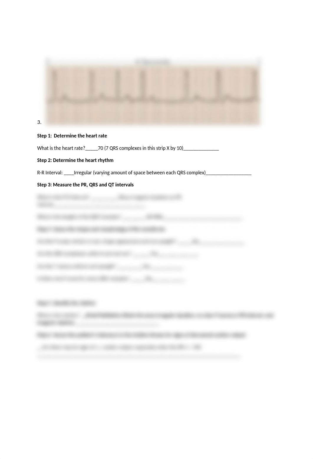 EKG in-class work sheet answers.docx_dzjvhilyy44_page5