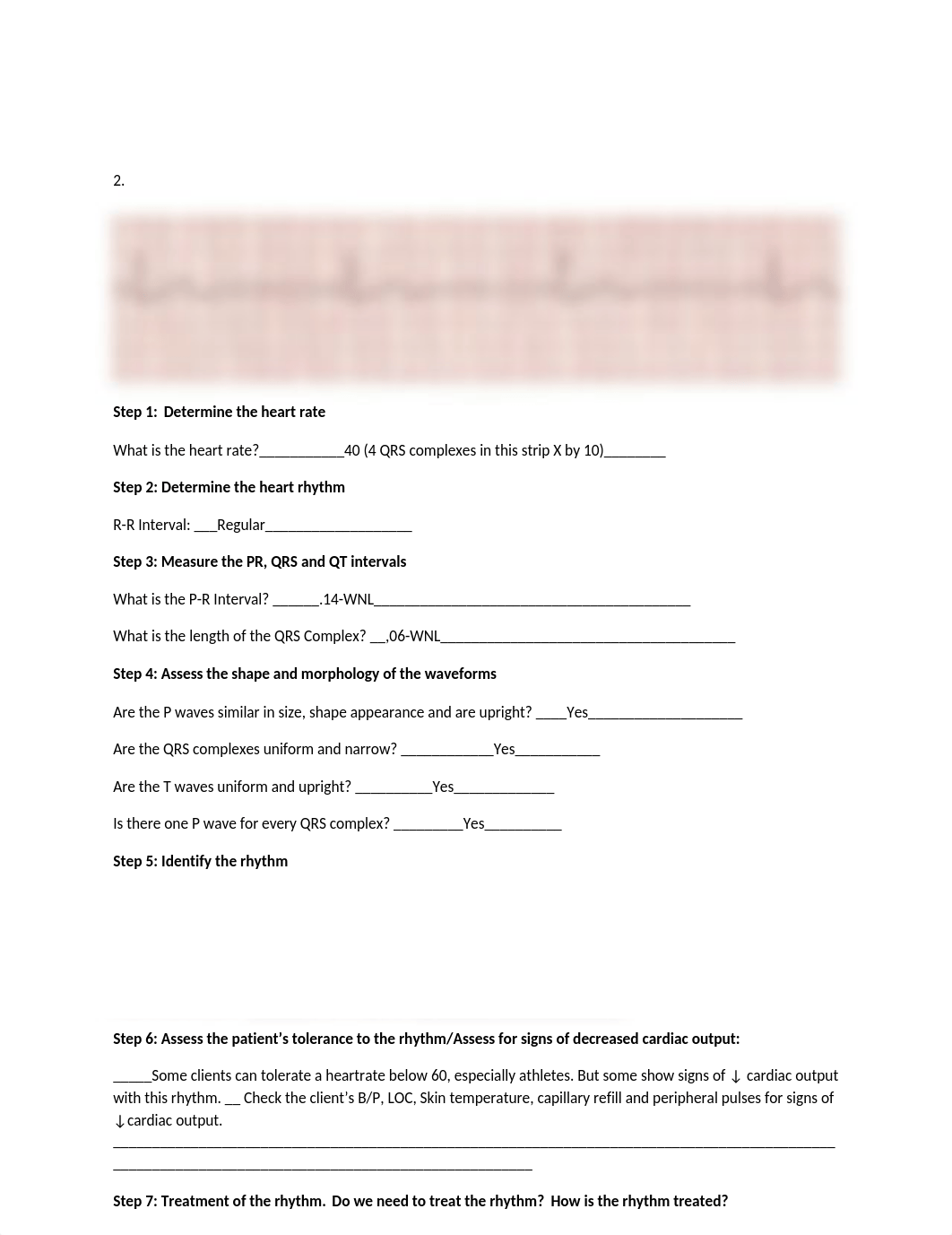 EKG in-class work sheet answers.docx_dzjvhilyy44_page3