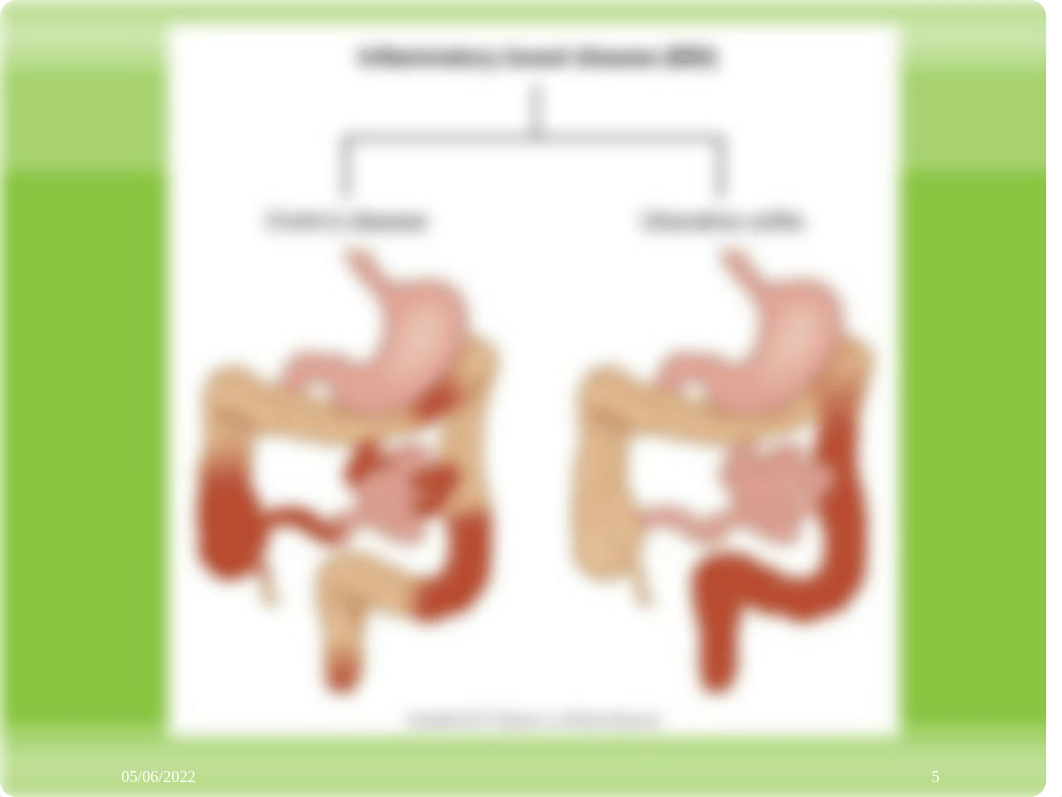 Inflammatory Bowel Disease ppt 2021 student (1).pptx_dznlqqp56tq_page5