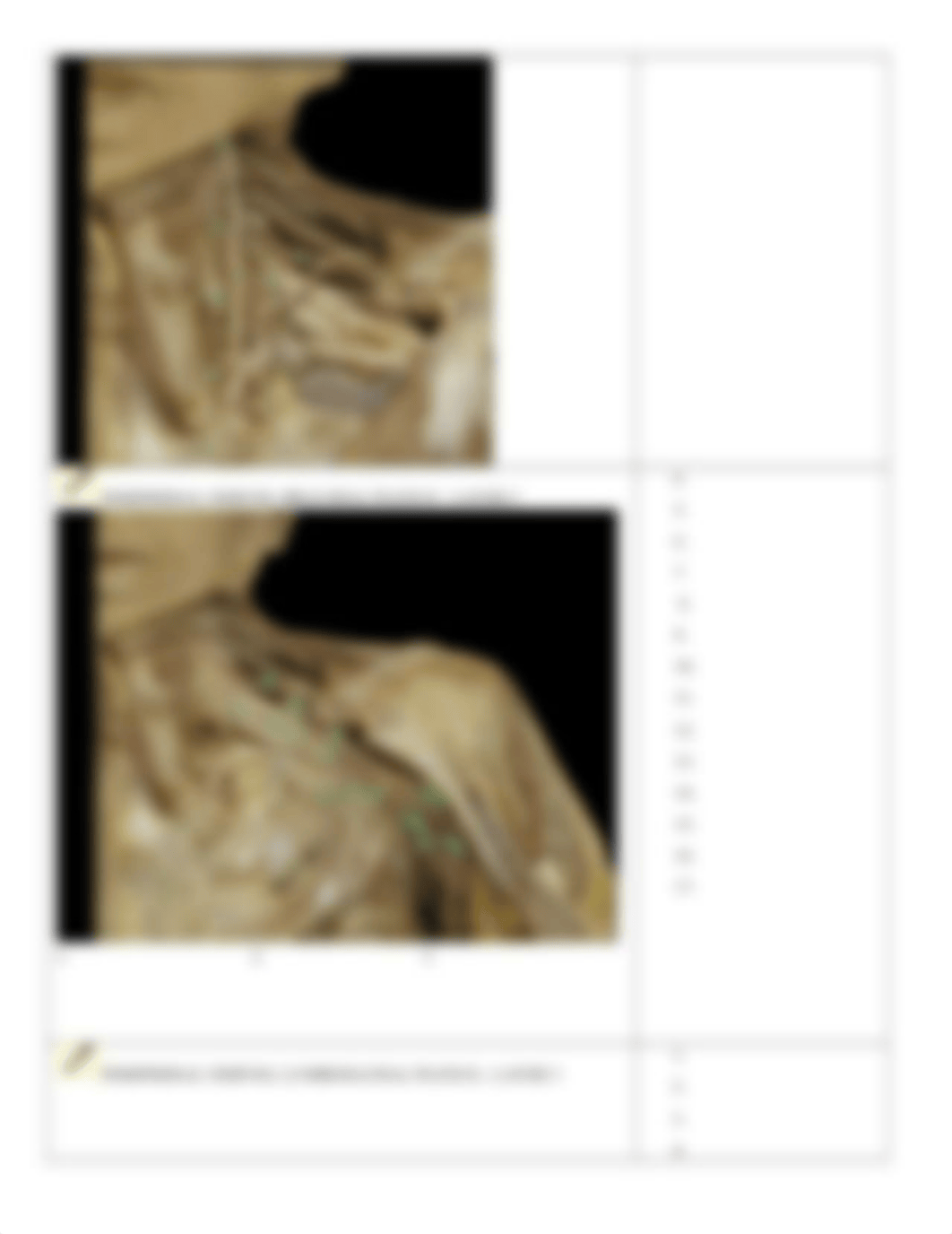 APR-NERVOUS SYSTEM-SPINAL CORD-NERVE ANATOMY-1.docx_dznsf0i0rl4_page4