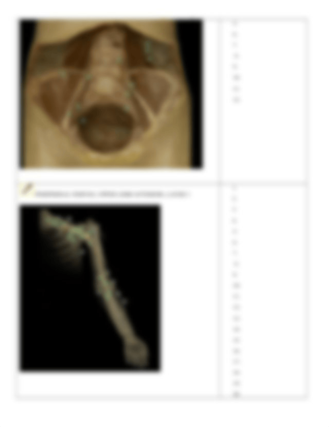 APR-NERVOUS SYSTEM-SPINAL CORD-NERVE ANATOMY-1.docx_dznsf0i0rl4_page5