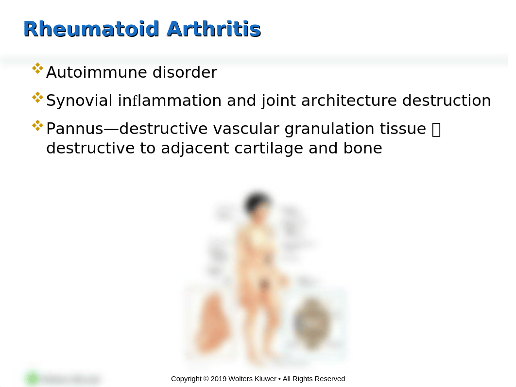 Chapter50 -  Musc. Rheumatic Disorders.pptx_dzp3ph7hg1g_page3