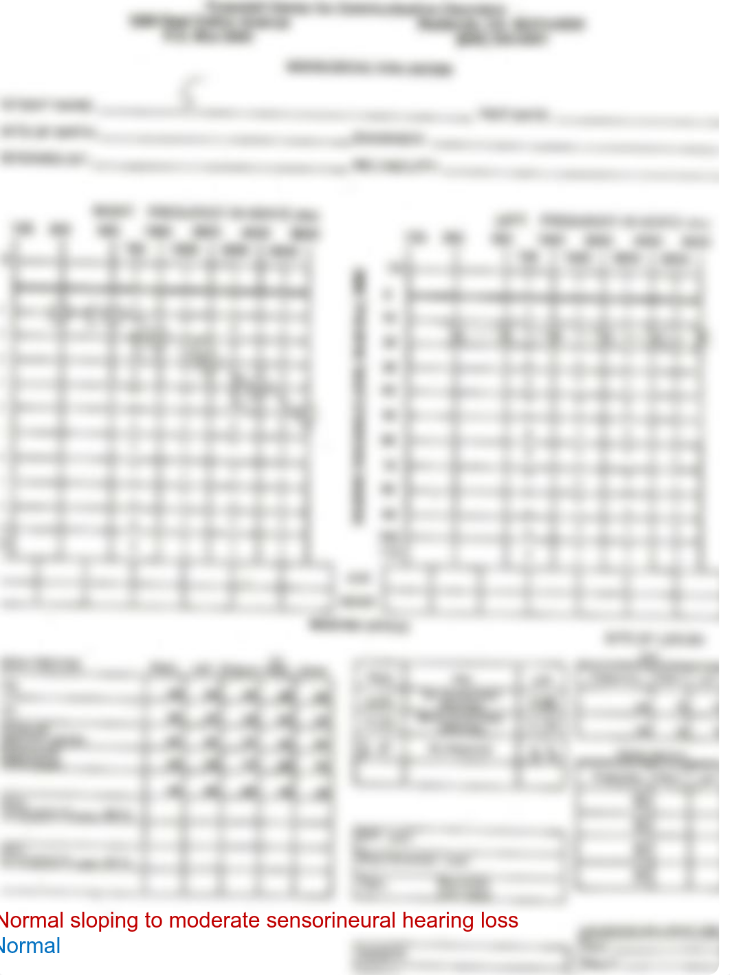 Audiology_interpretation_homework.pdf_dztg1lz8sbq_page5