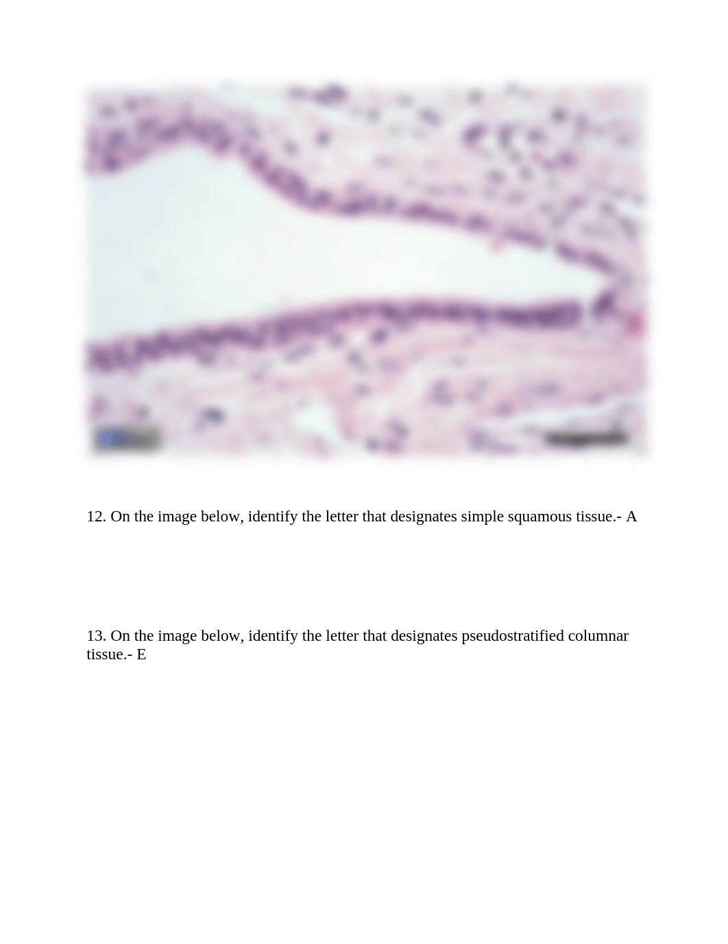 HistologyEpithelialTissuesQuestions.SamantaRangelLemus (1).docx_dzvcrh3cjlv_page4