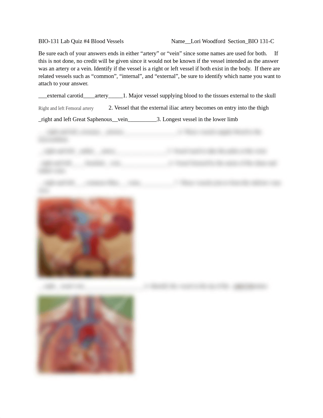 Lab Quiz #4 Blood Vessels 2021 1.docx_dzwkmq4xgx6_page1