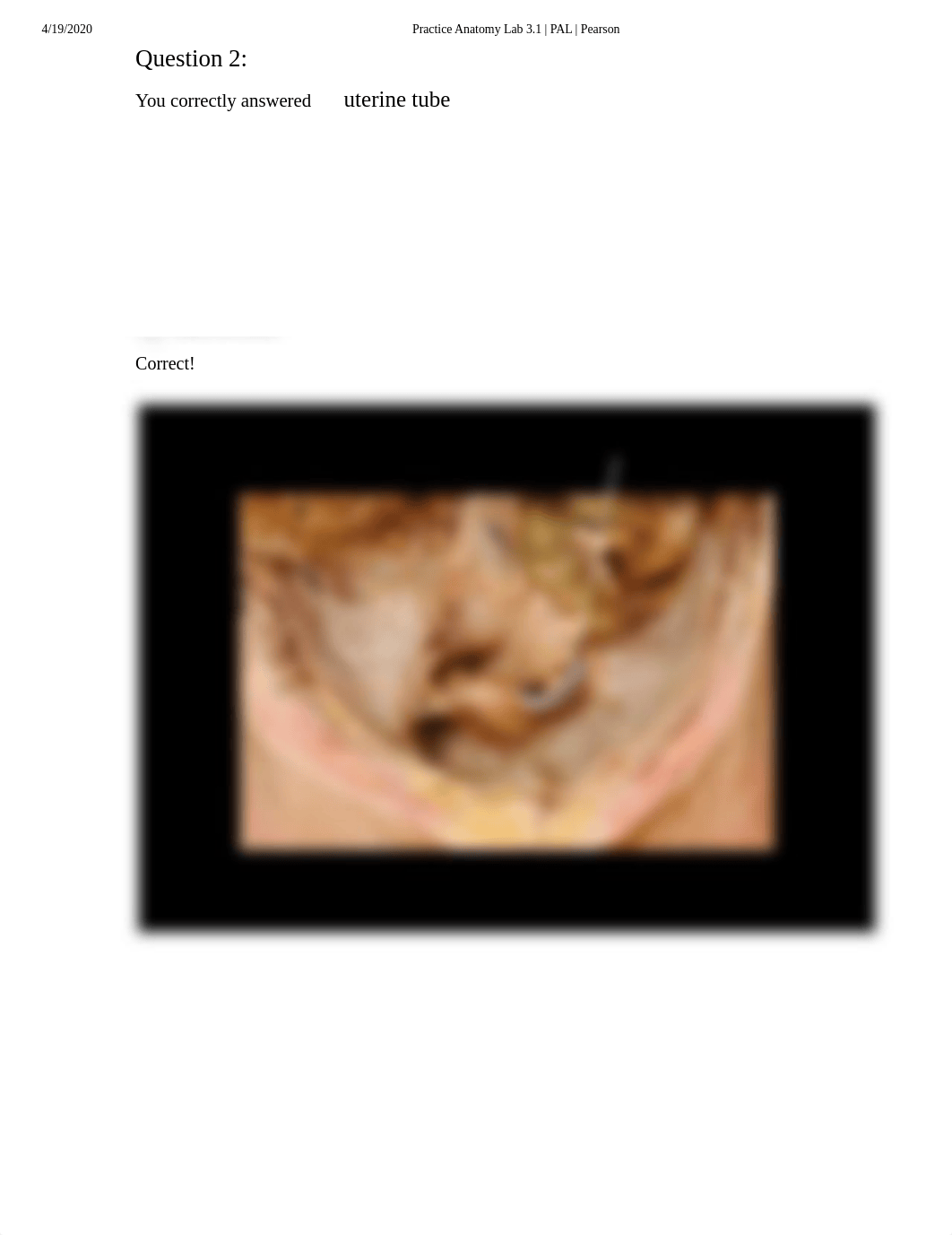 Doris Bowdre Human Cadaver  Reproductive System Quiz.pdf_dzyfny1azzm_page3