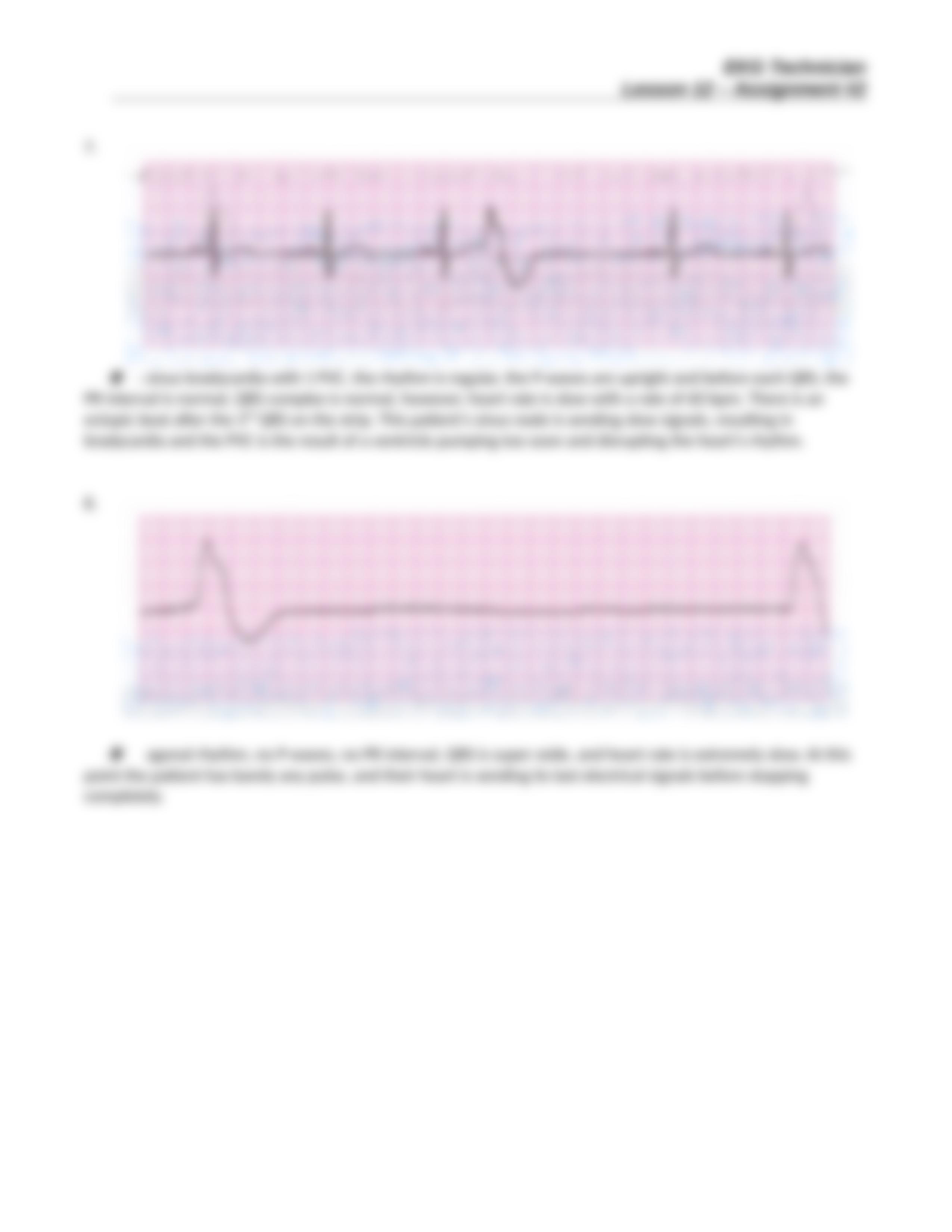 EKG Technician Lesson 12 Assignment Two 042116(1).doc_d1kzlxo61p9_page4