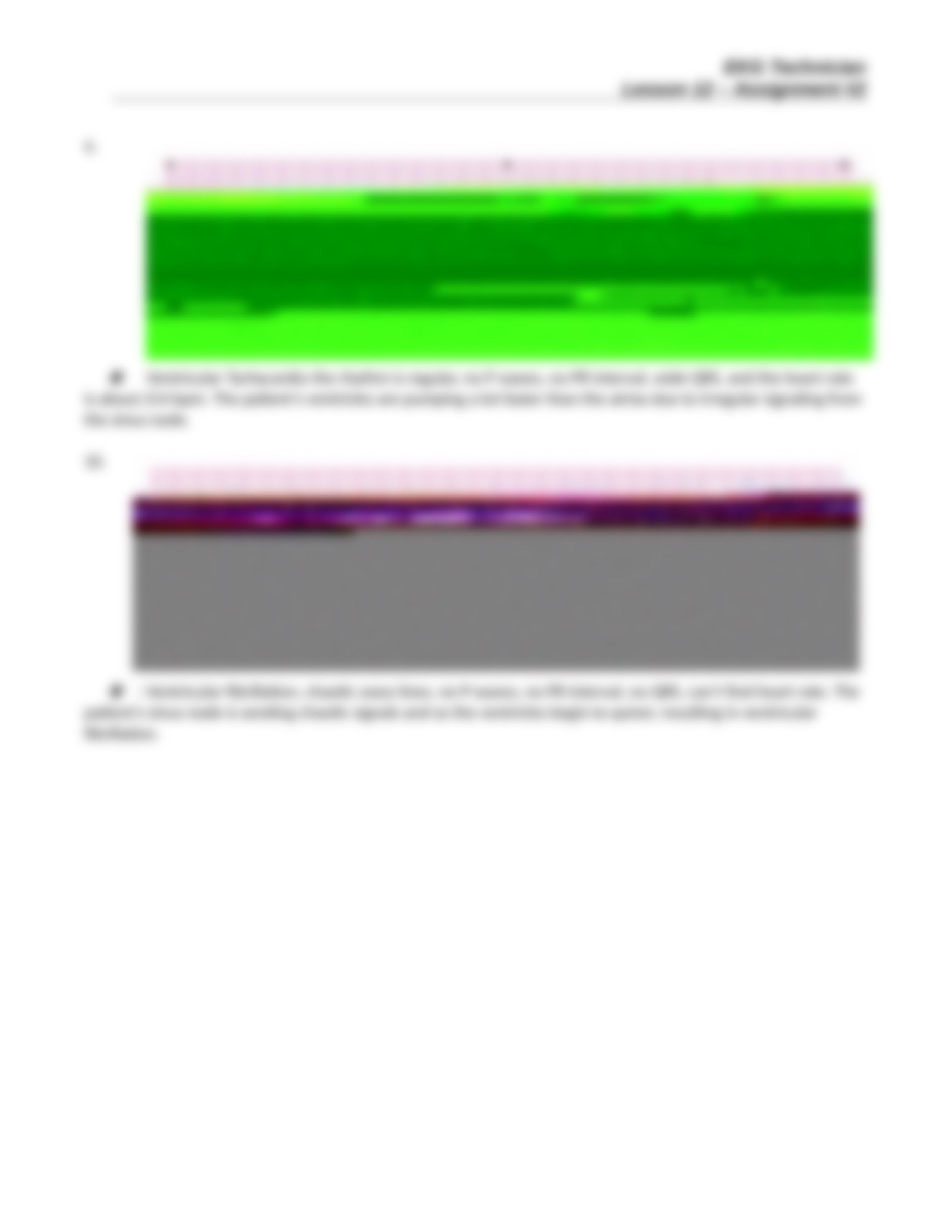 EKG Technician Lesson 12 Assignment Two 042116(1).doc_d1kzlxo61p9_page5