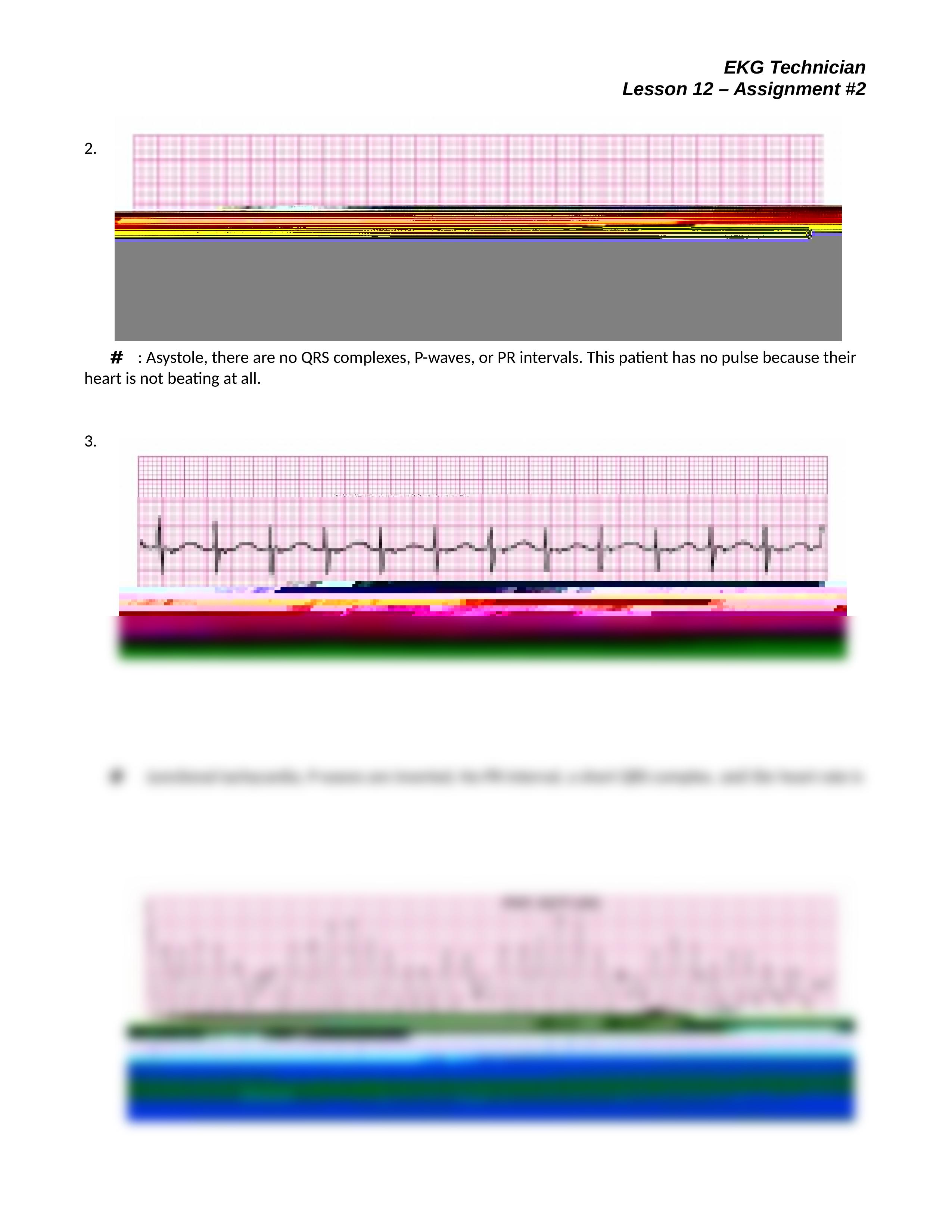 EKG Technician Lesson 12 Assignment Two 042116(1).doc_d1kzlxo61p9_page2