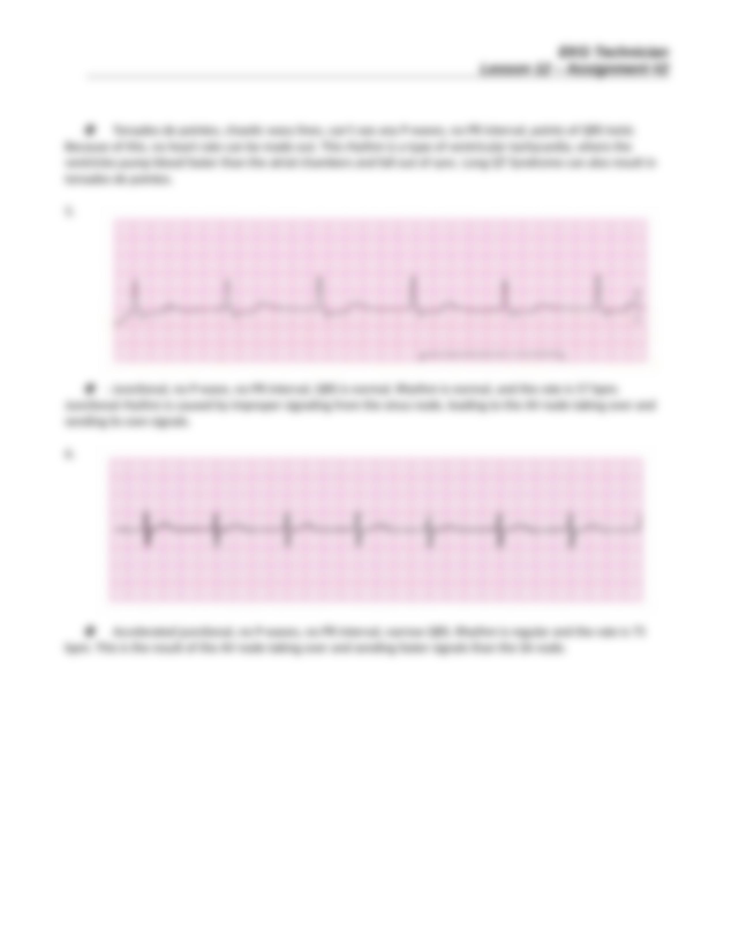 EKG Technician Lesson 12 Assignment Two 042116(1).doc_d1kzlxo61p9_page3