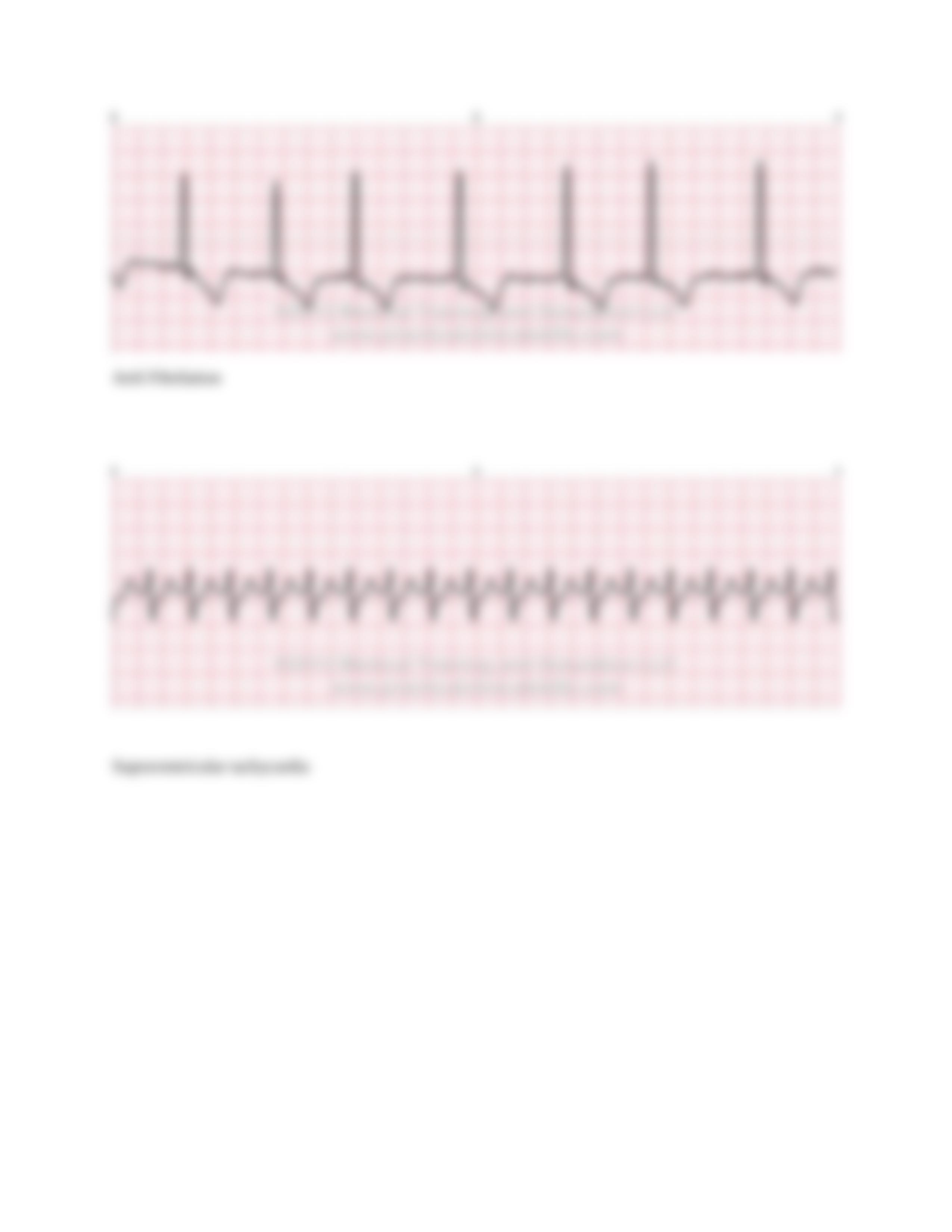 Dysrhythmia Case Study (1).docx_d3bvqtbni6t_page4