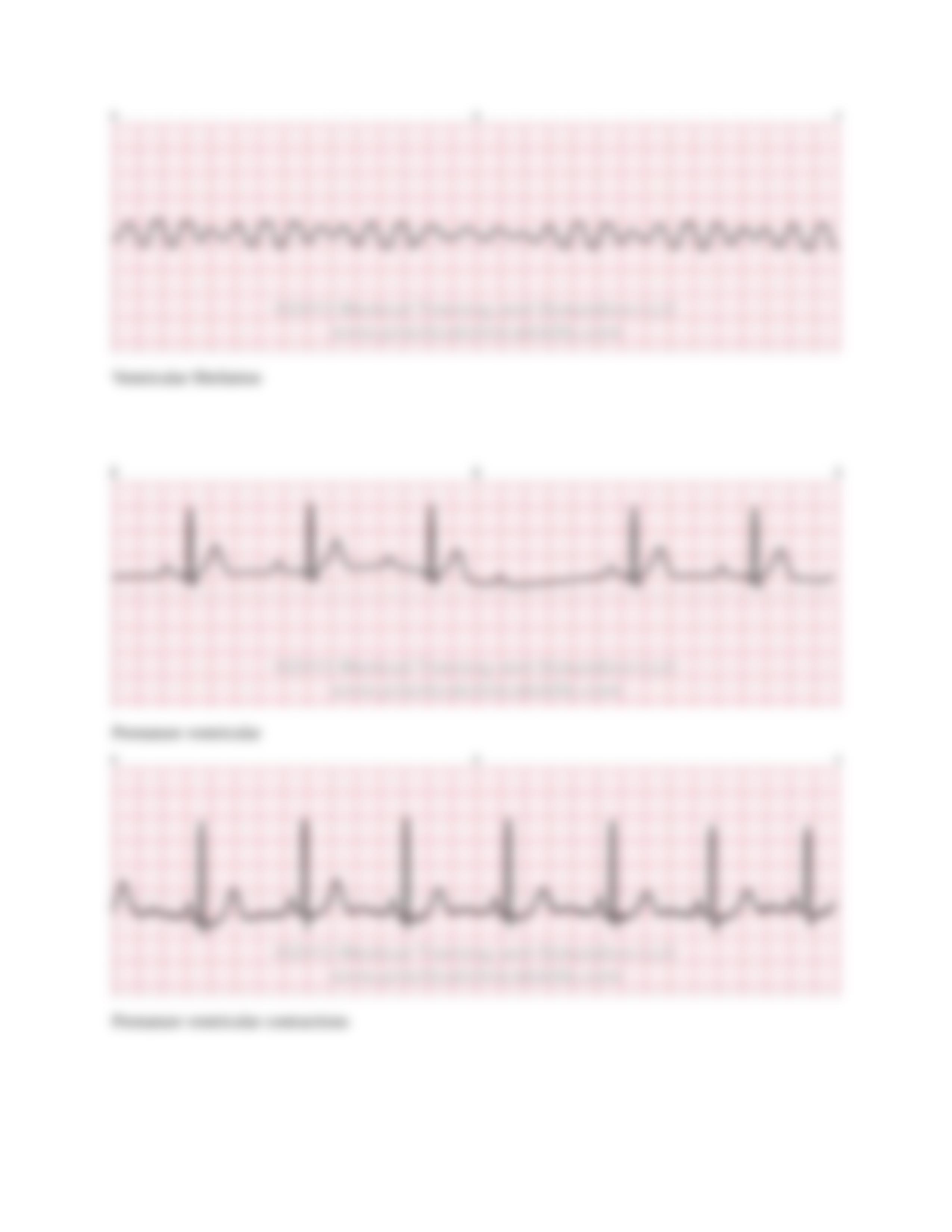 Dysrhythmia Case Study (1).docx_d3bvqtbni6t_page3