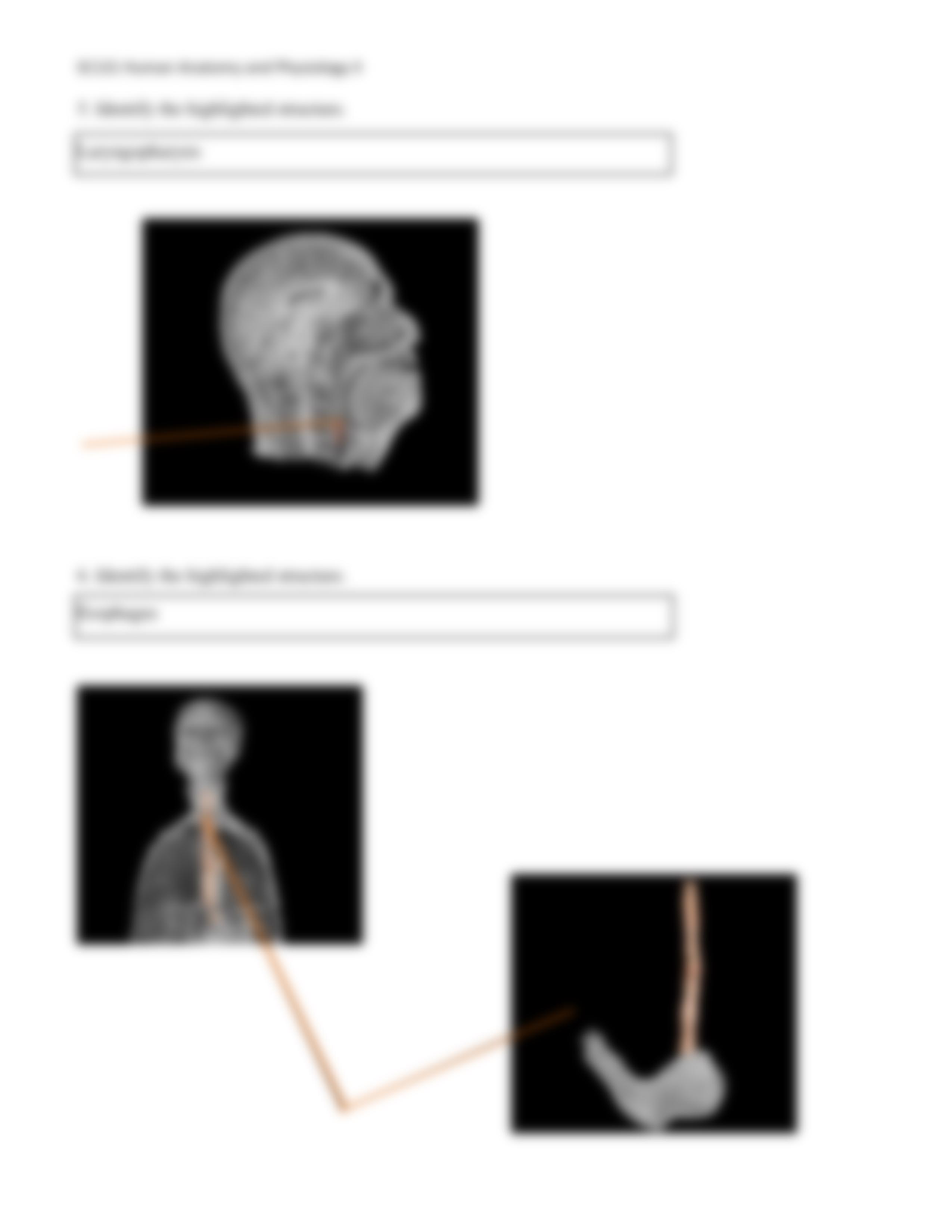 A&p 2 UNIT 5 ASSIGNMENT_d54tph0qgkj_page3