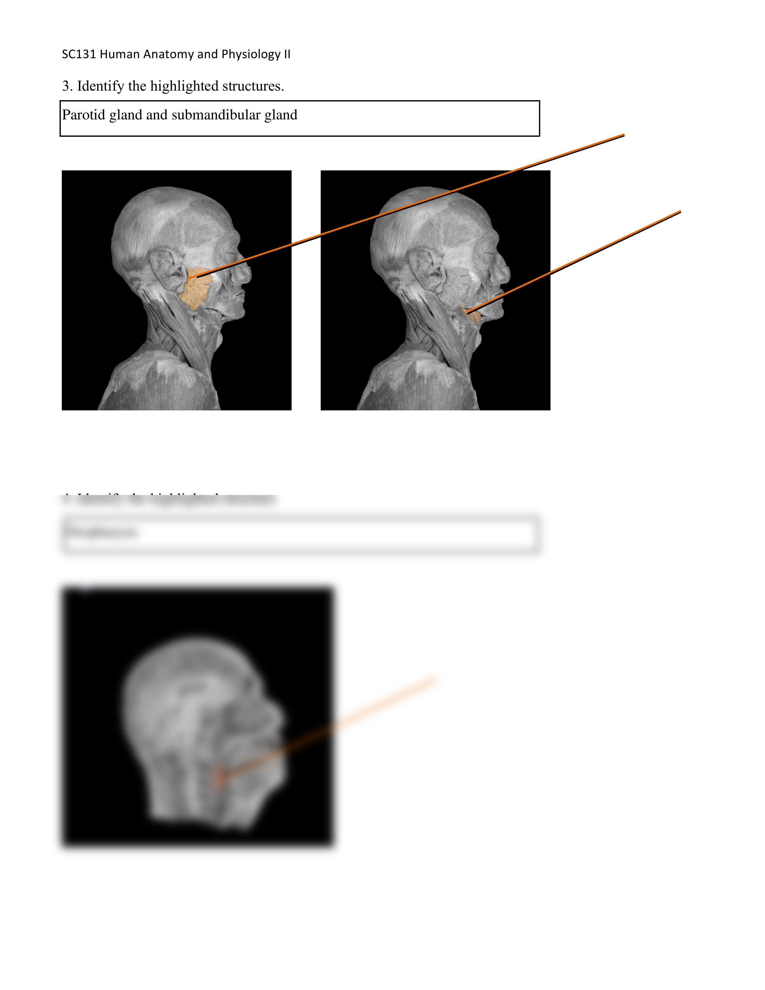 A&p 2 UNIT 5 ASSIGNMENT_d54tph0qgkj_page2