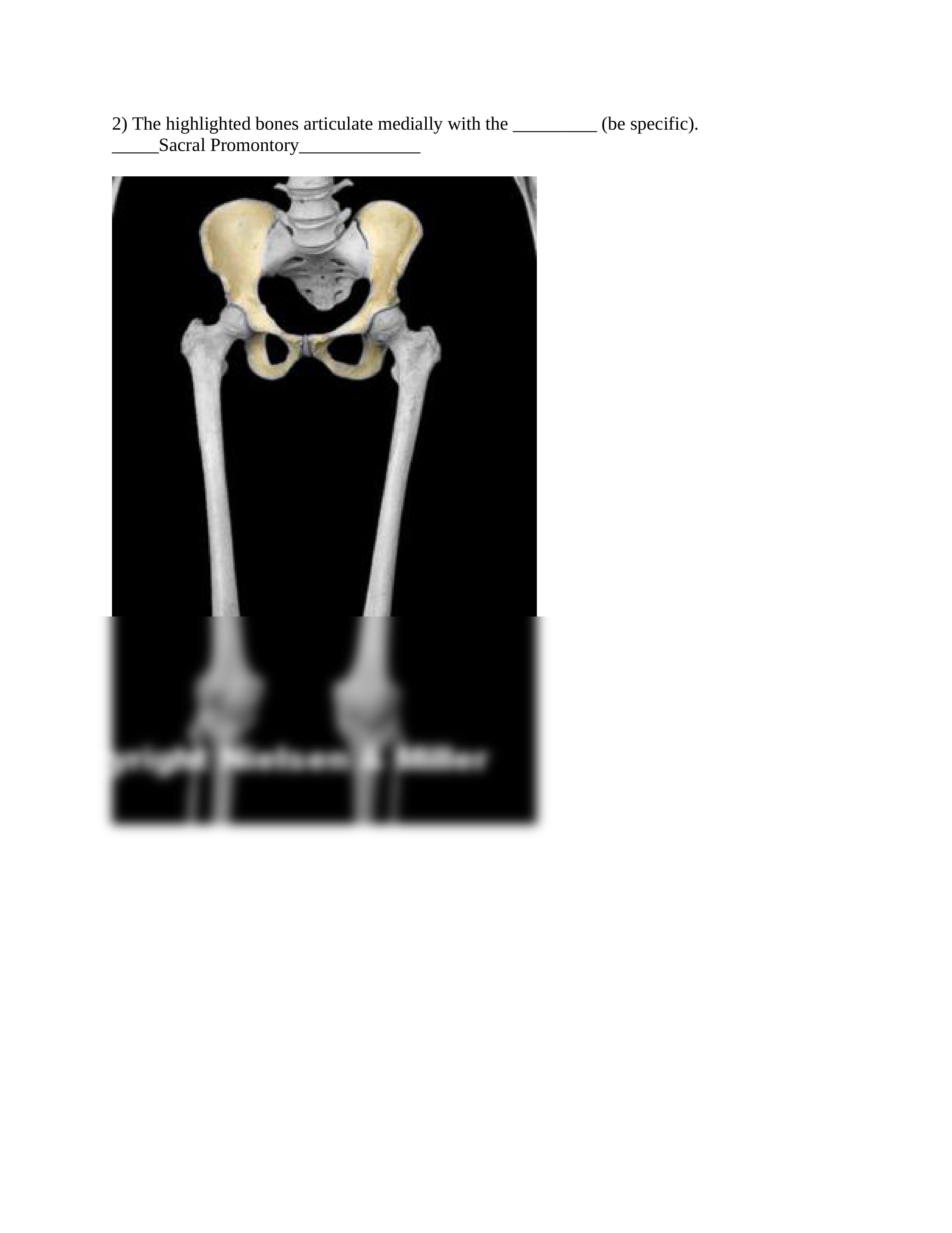 10_lower_limb_skeletal_articulation_Worksheet.docx_dbpbmr4o7ek_page2