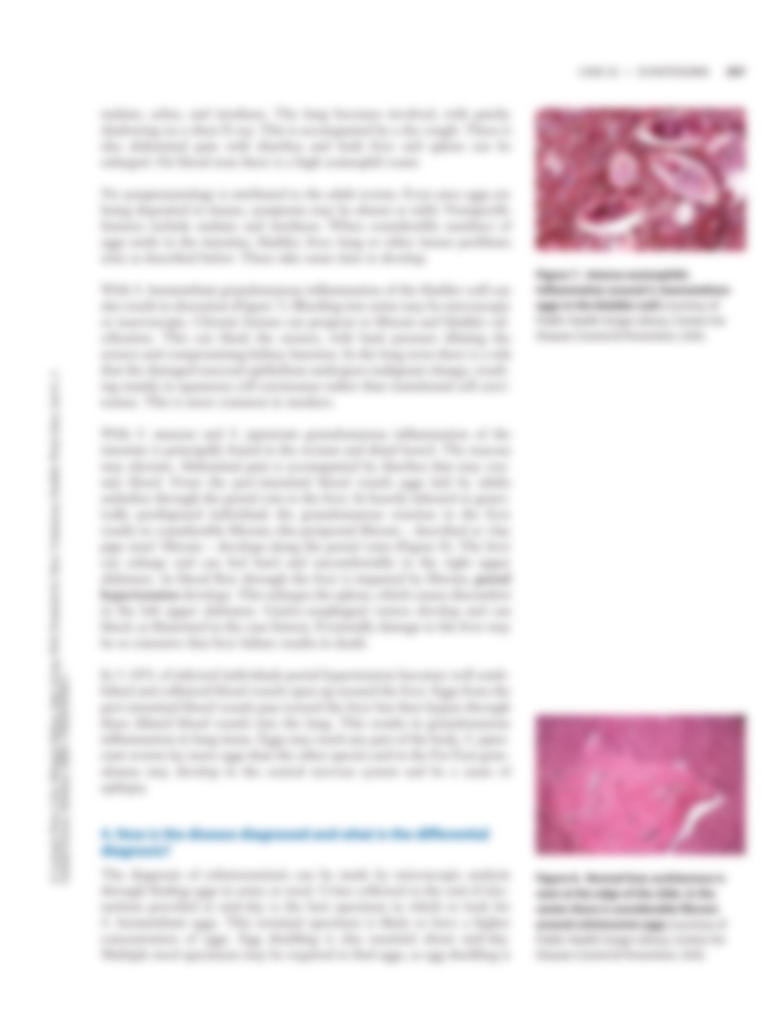 case32 - Schistosoma_dcdd7evukoy_page5