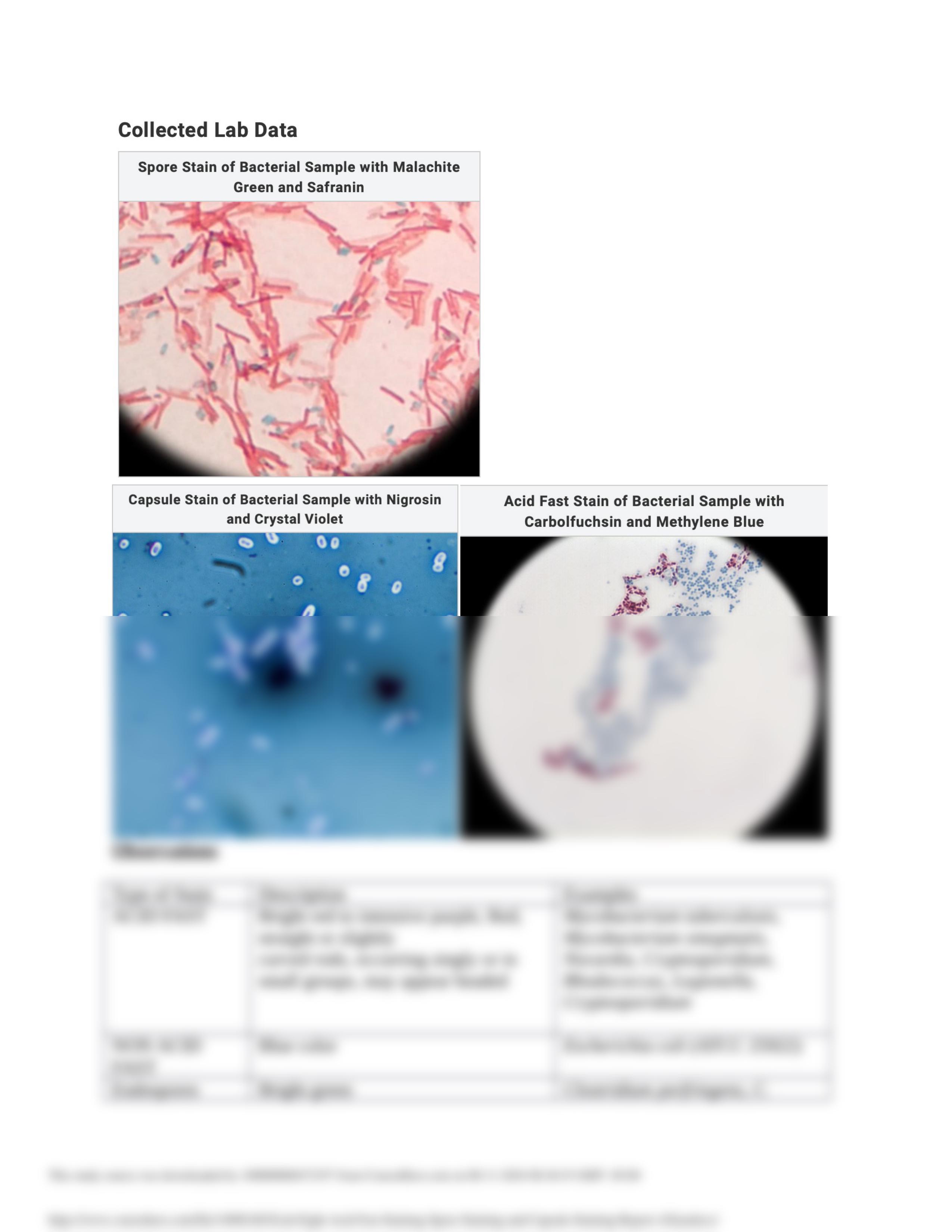 Lab Eight- Acid-Fast Staining, Spore Staining and Capsule Staining Report_AXiao.docx_dd9f1iqsicq_page2