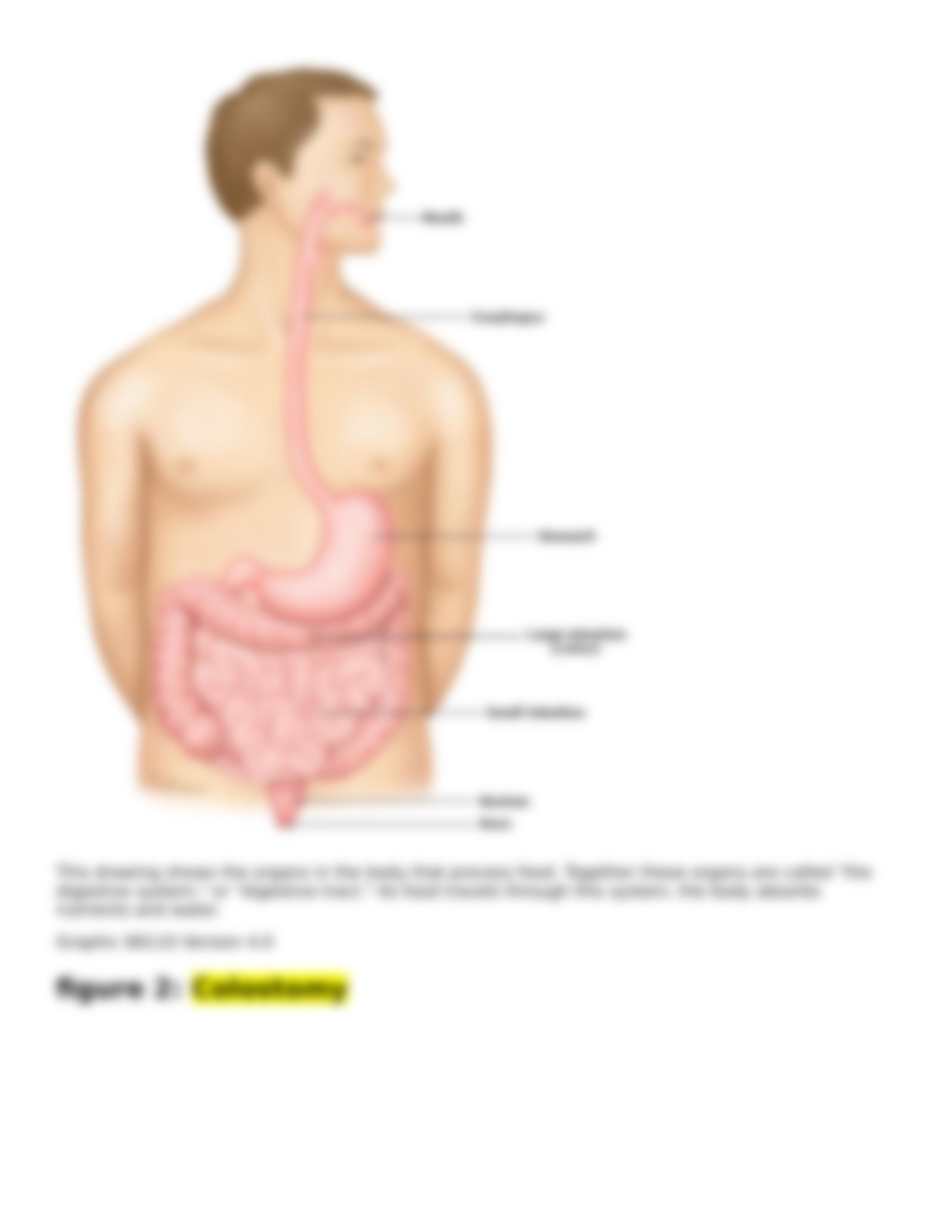 Colostomy Care Teaching Plan.docx_de5n97is10j_page4