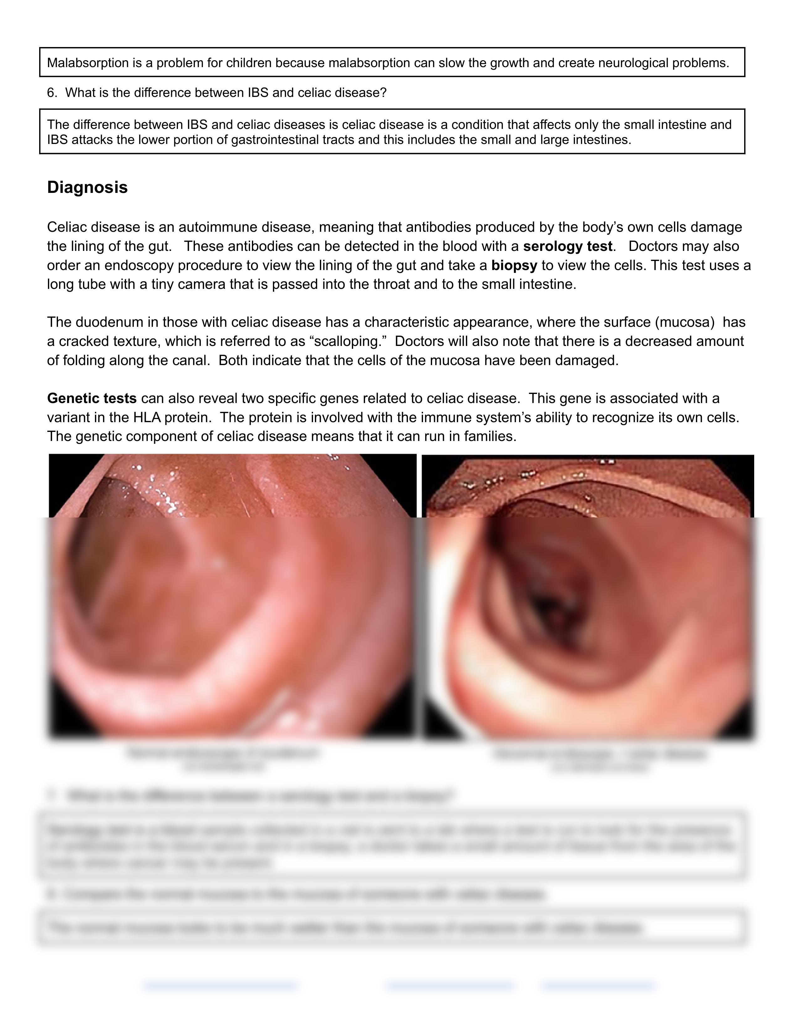 Case Study - Celiac Disease.pdf_df2d41tggnu_page2