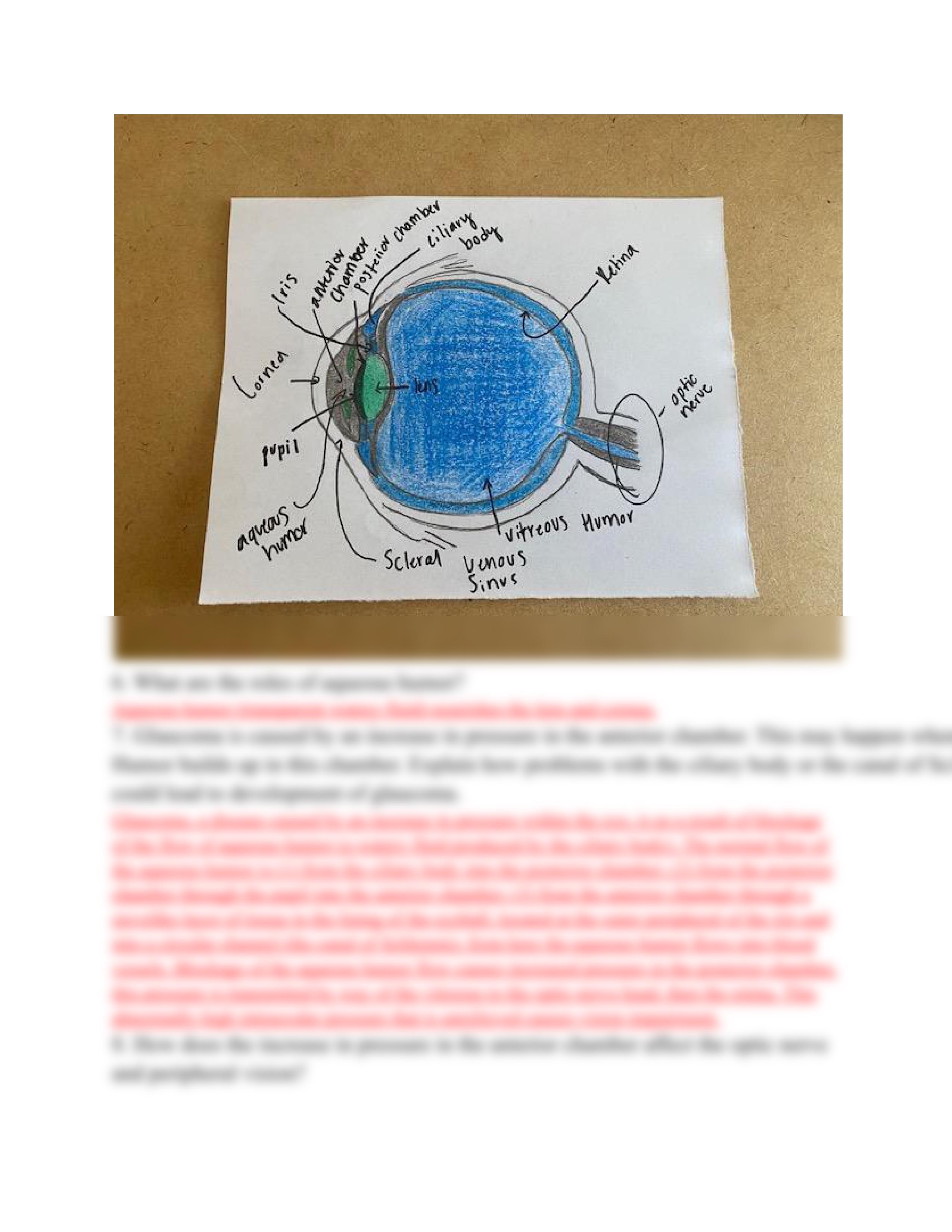 A trip to the eye doctor case study DONE.pdf_dg1ud62vkta_page2