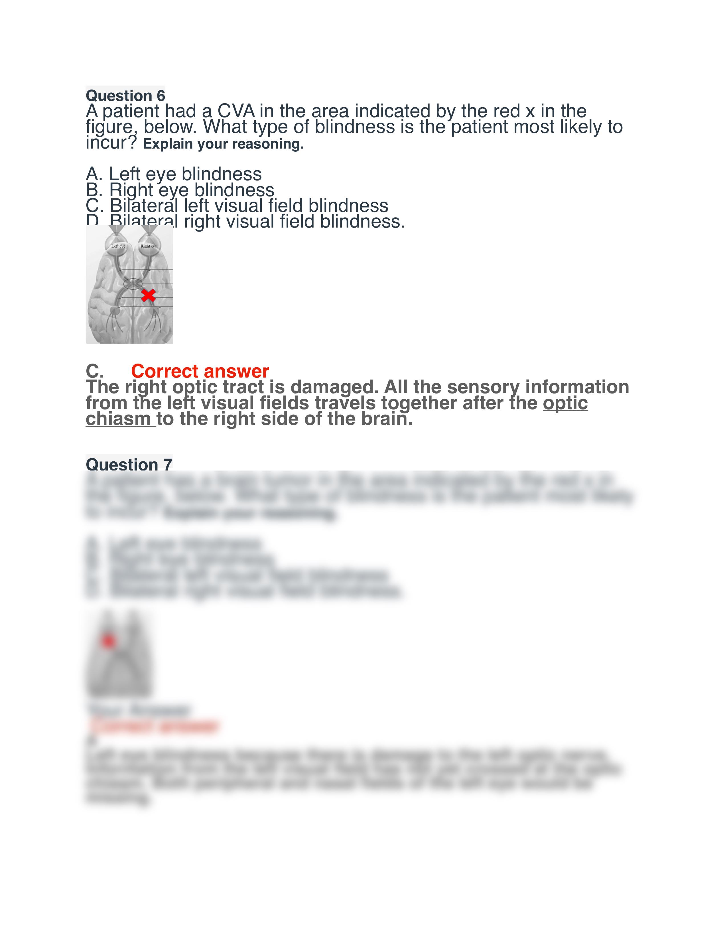 Module 3 Exam A&P 2 BIOD 152.pdf_dhntcs7aac9_page2