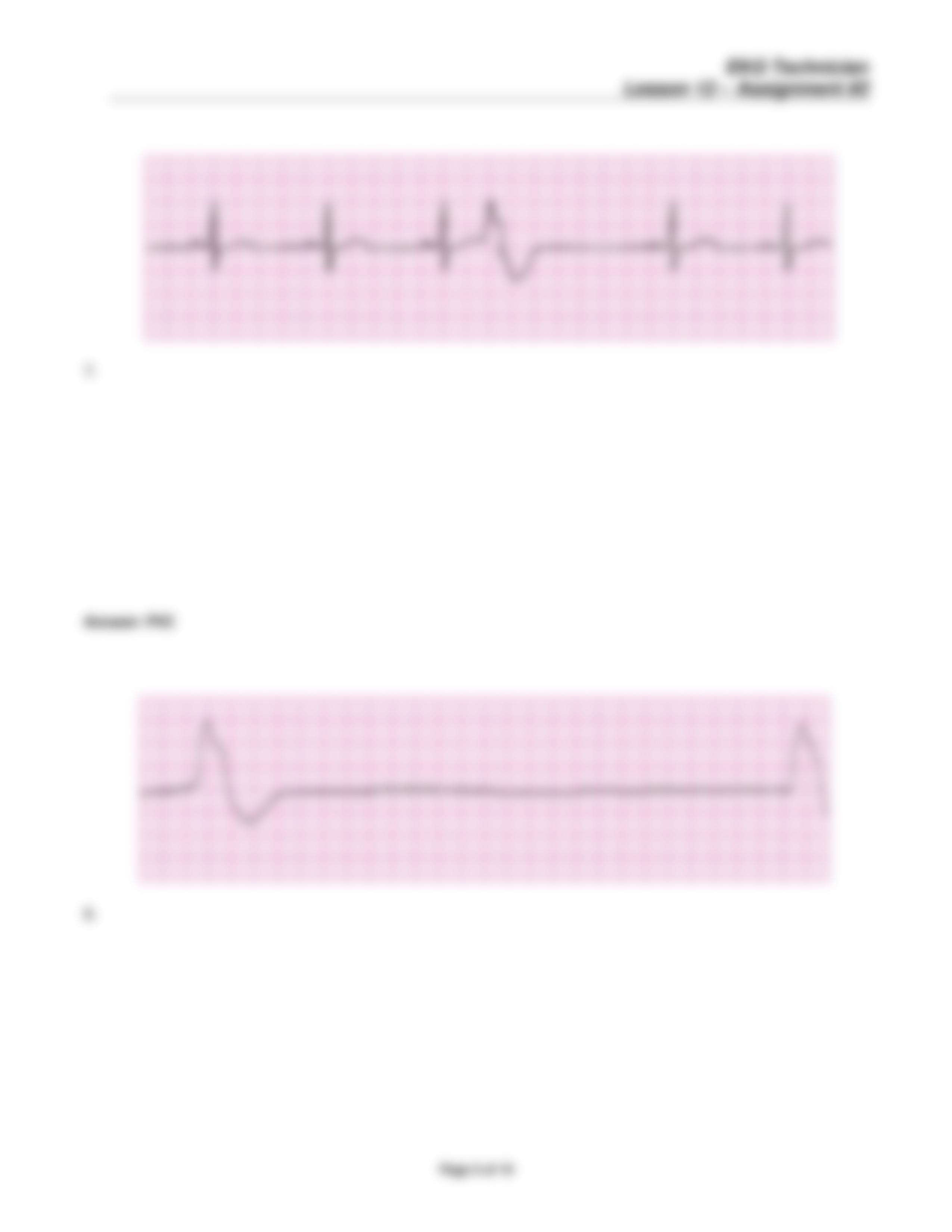 EKG Technician Lesson 12 Assignment Two 042116(1).pdf_dj4bpvflkev_page5