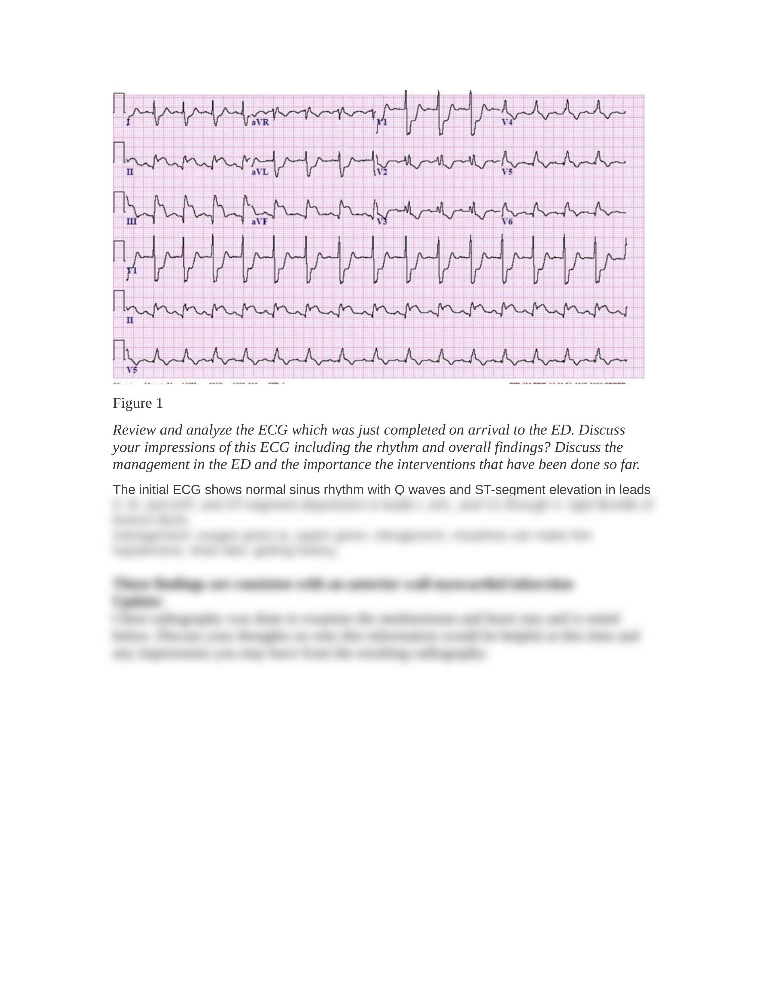 N 375 Case Study Cardiovascular 2020-2021.docx_dnp3dzo5r9y_page2