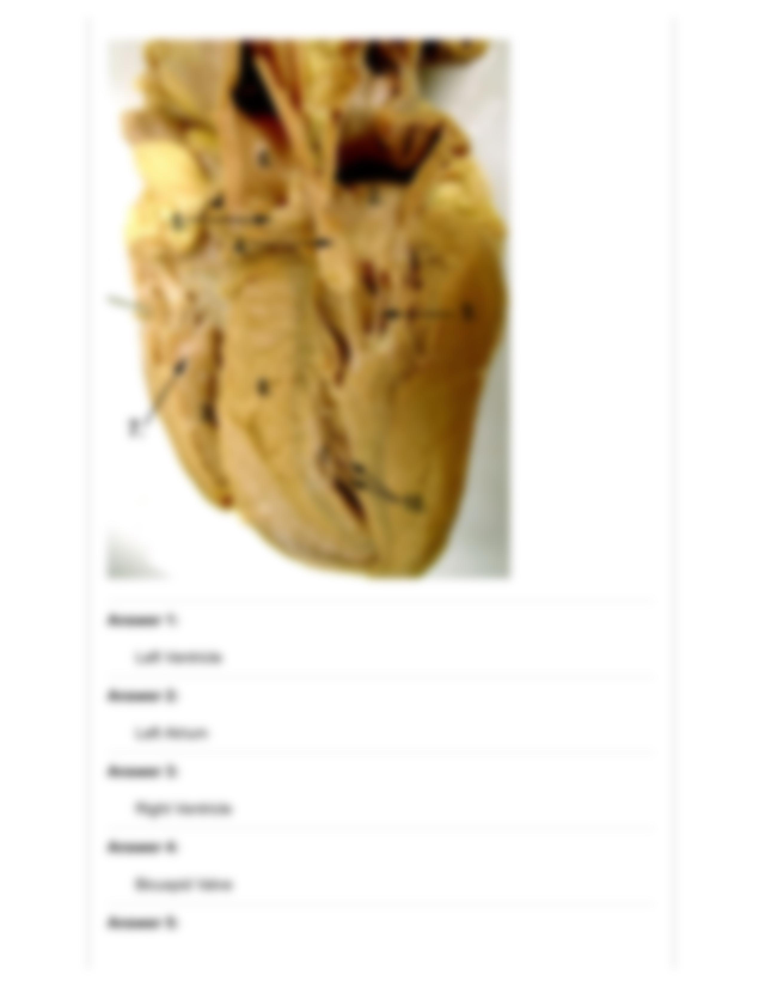 Exercise 2_ Post-Lab Heart Dissection Quiz_ Human A & P II Laboratory (BIOL-254-WA2 CRN_ 23790).pdf_dsikf3rmfj6_page4