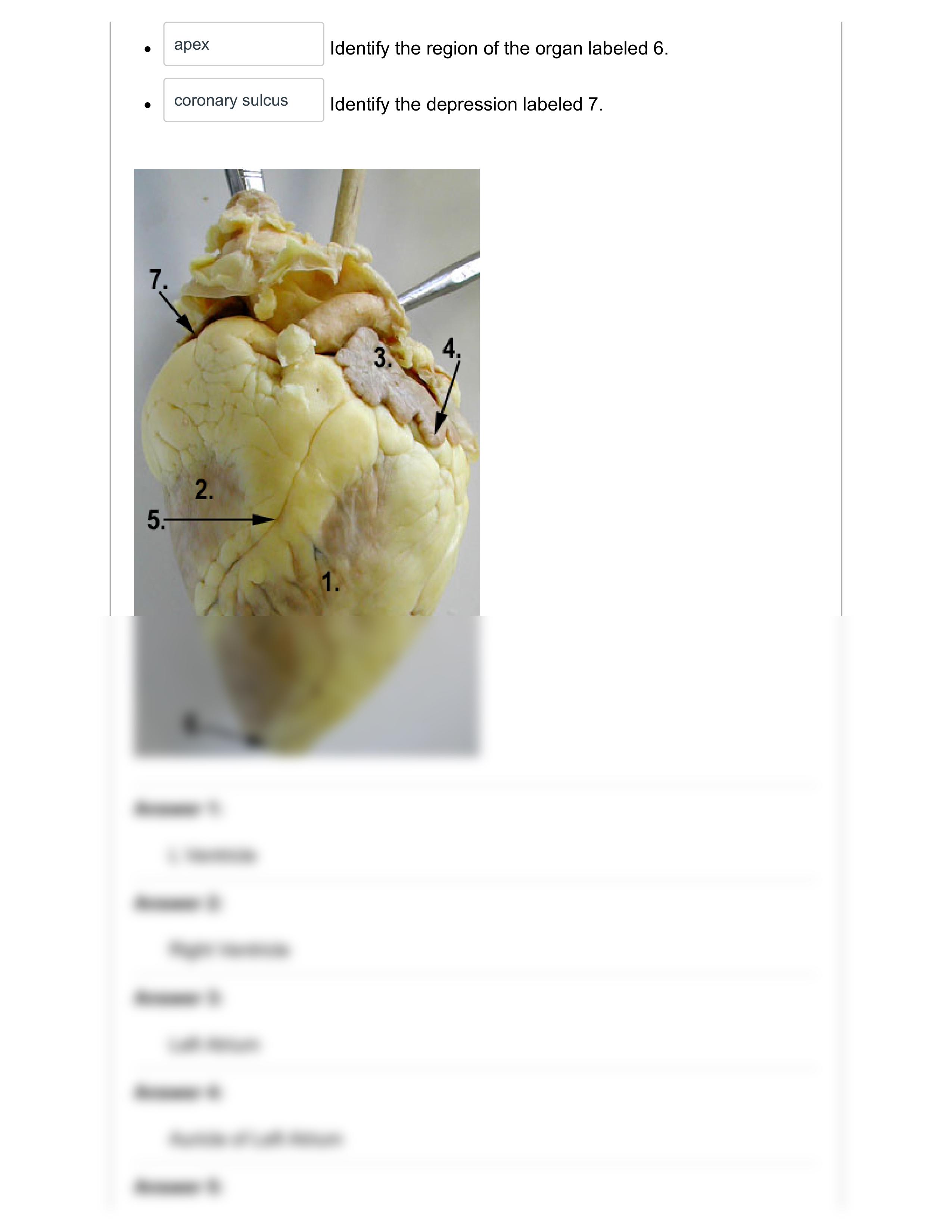 Exercise 2_ Post-Lab Heart Dissection Quiz_ Human A & P II Laboratory (BIOL-254-WA2 CRN_ 23790).pdf_dsikf3rmfj6_page2