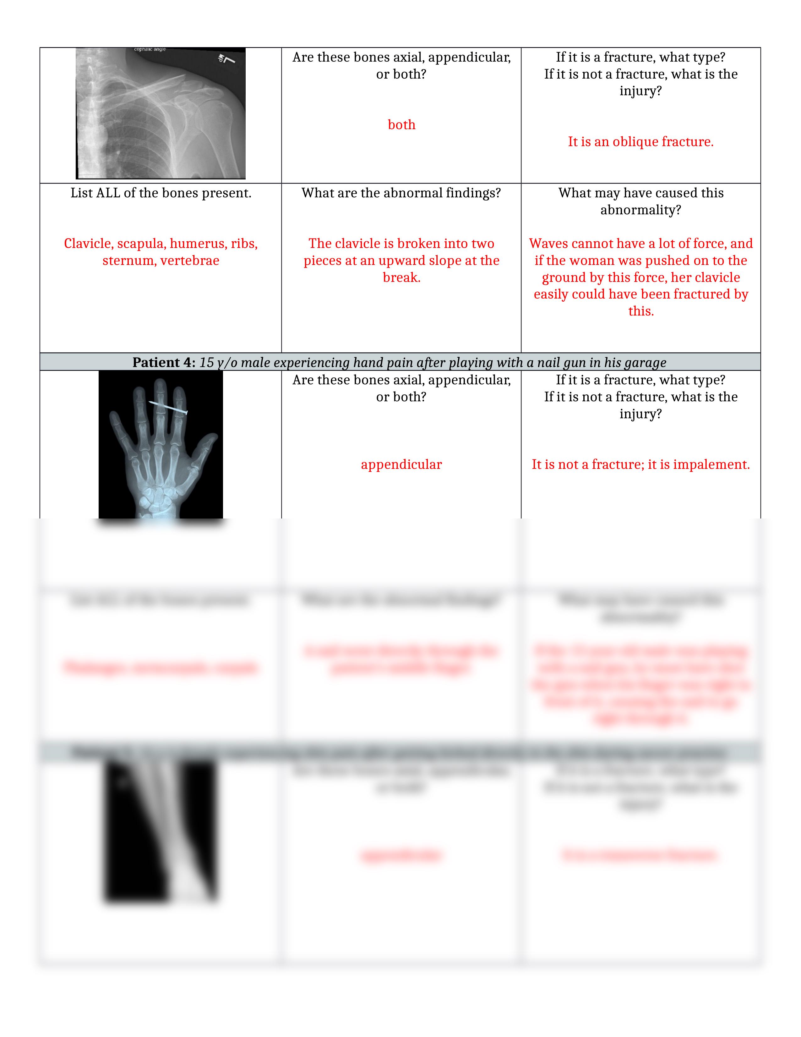 X-Rays and Fractures.docx_du7mpfkadbh_page2