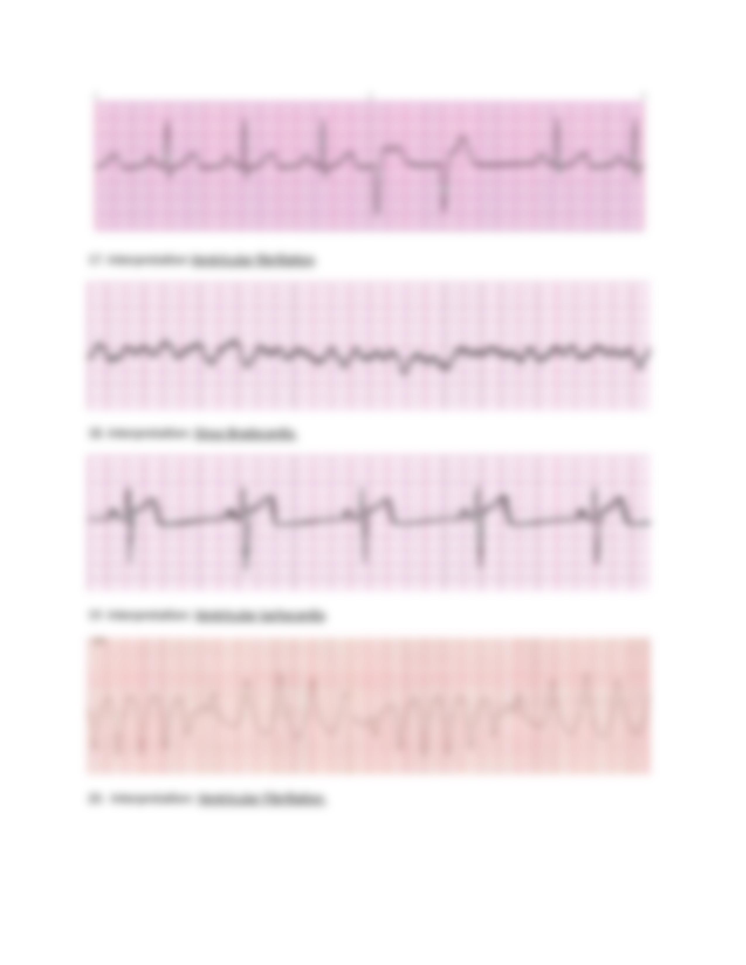 EKG Packet F20.docx_dv3p7gqqxqp_page5