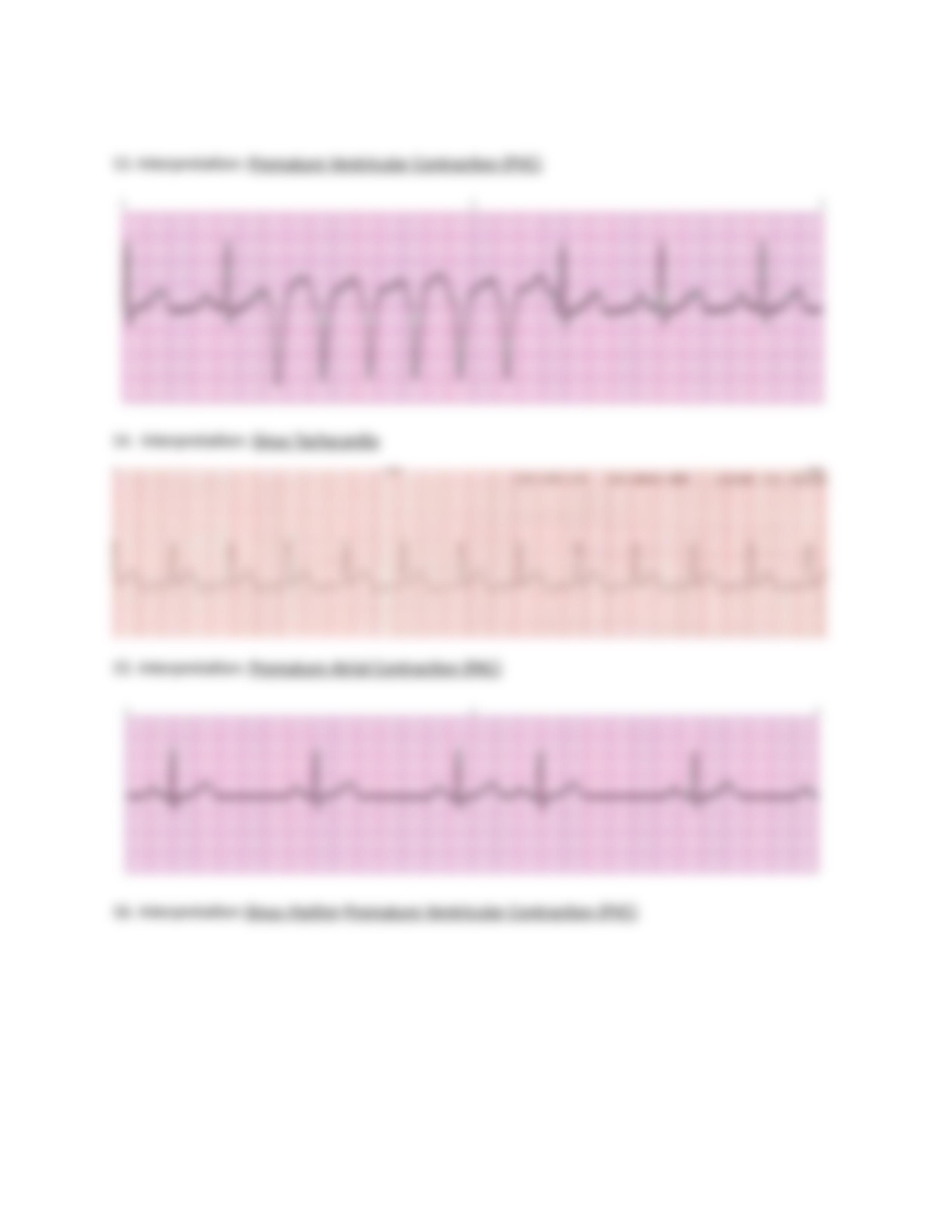 EKG Packet F20.docx_dv3p7gqqxqp_page4