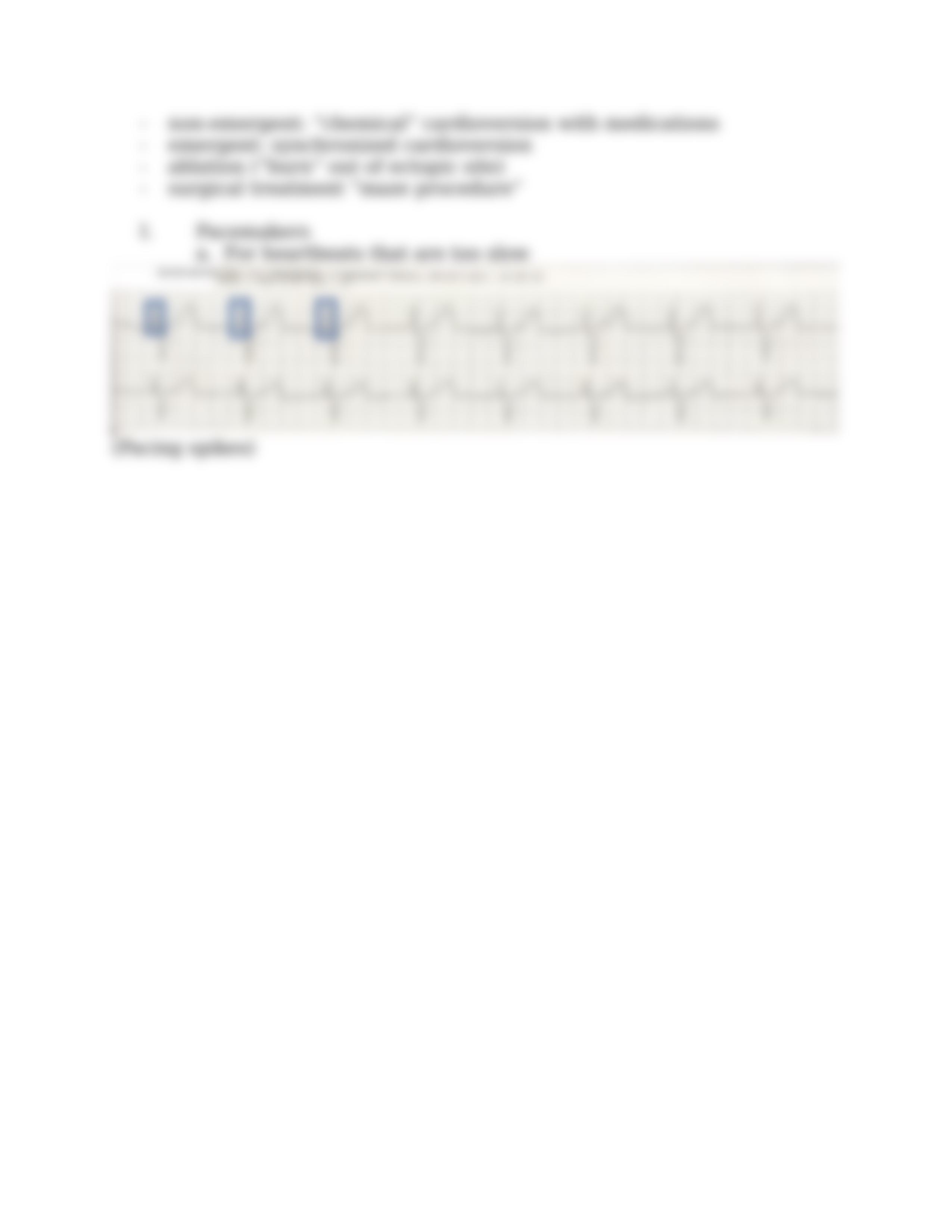 EKG Strips.docx_dwoxedy4g2u_page4