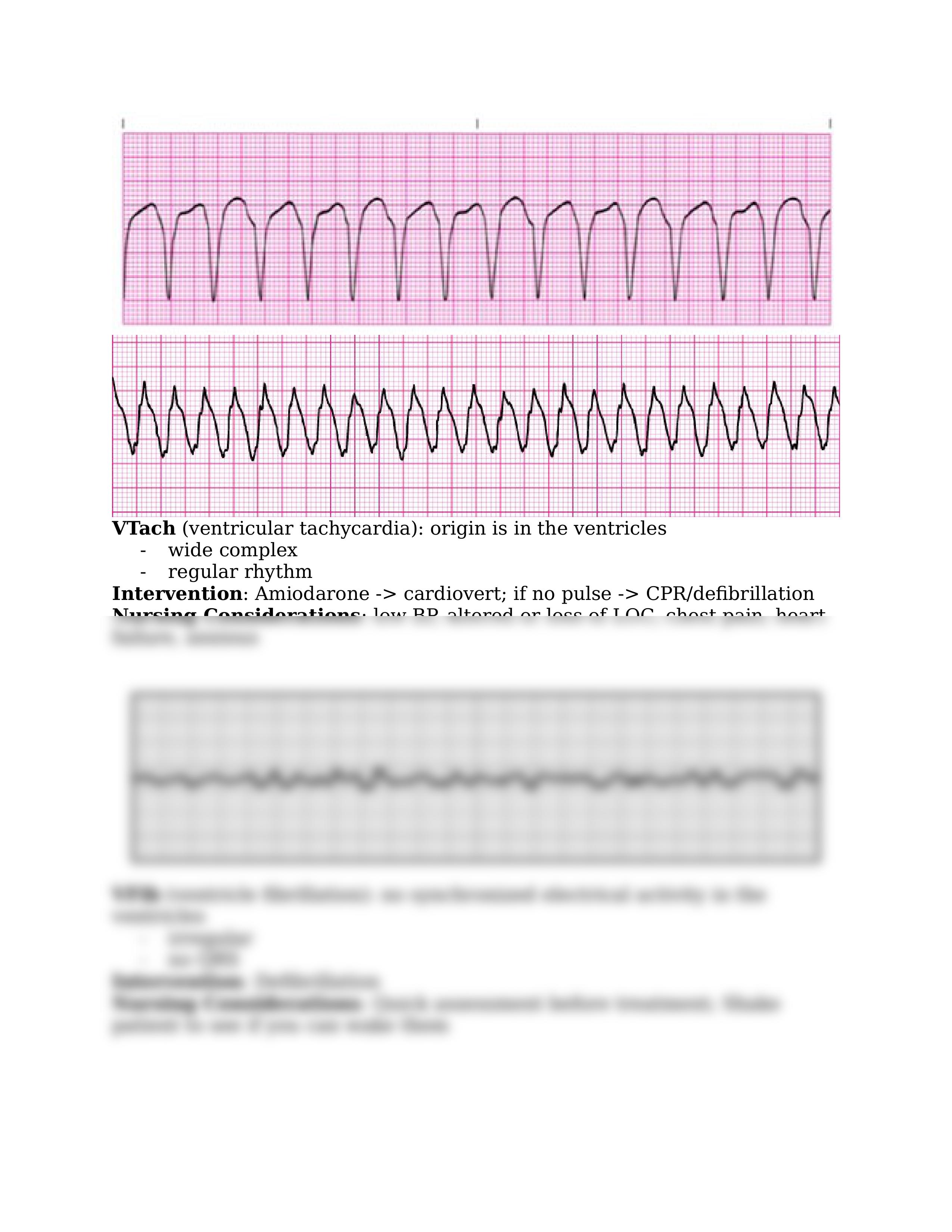 EKG Strips.docx_dwoxedy4g2u_page2