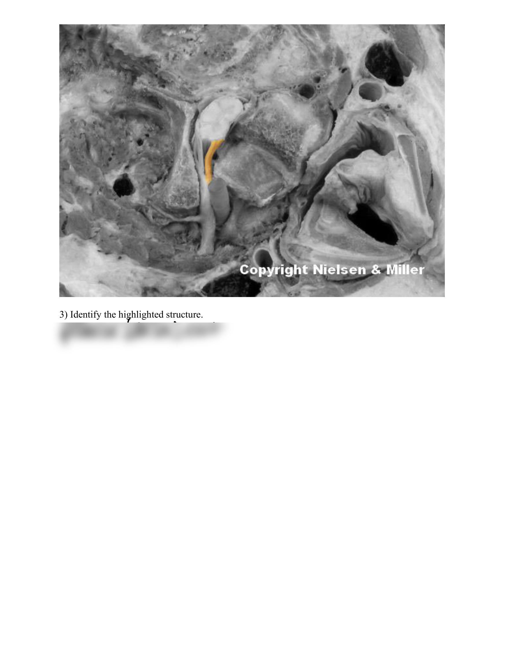 30_spinal_cord_and_nerves_anatomy_Worksheet.pdf_dz3mrbd79qt_page2