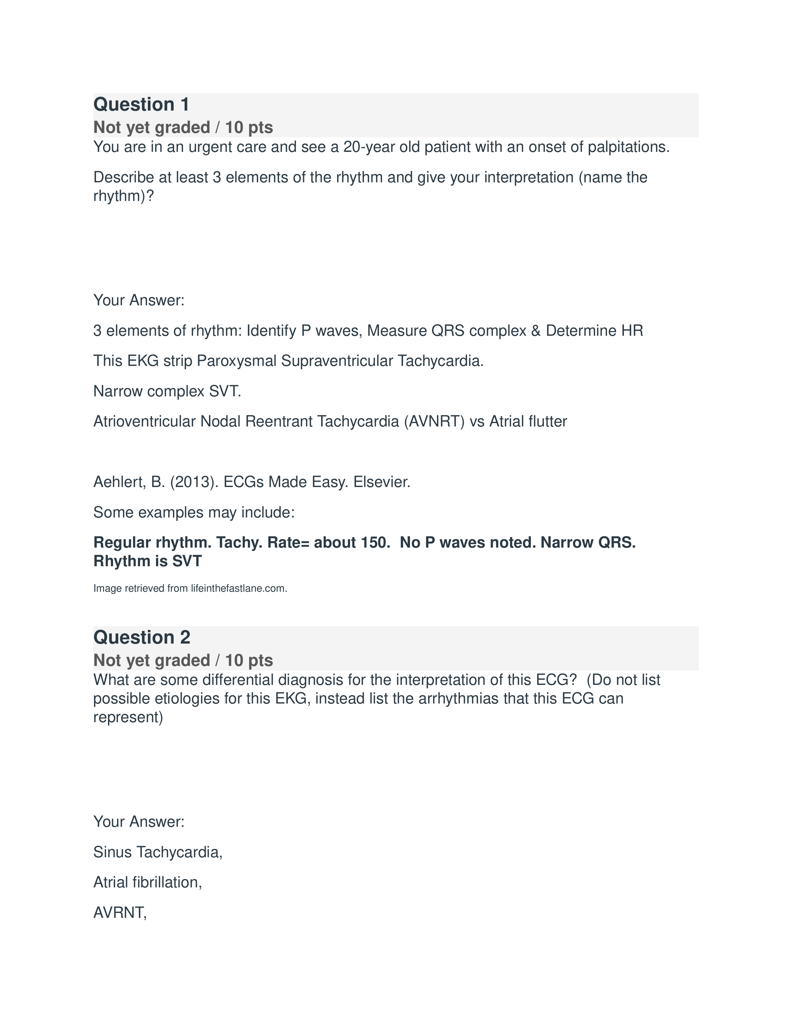 EKG quiz.docx_d5u688g5p6a_page1