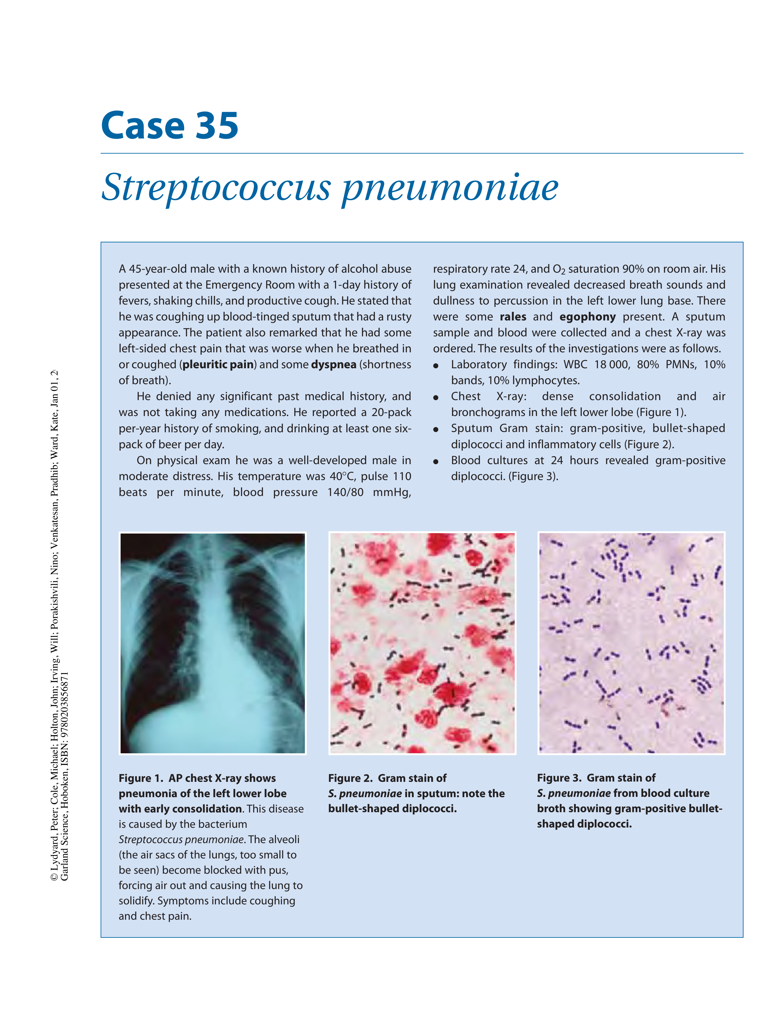 case35. streppneumoniae_d76ul5q92ye_page1